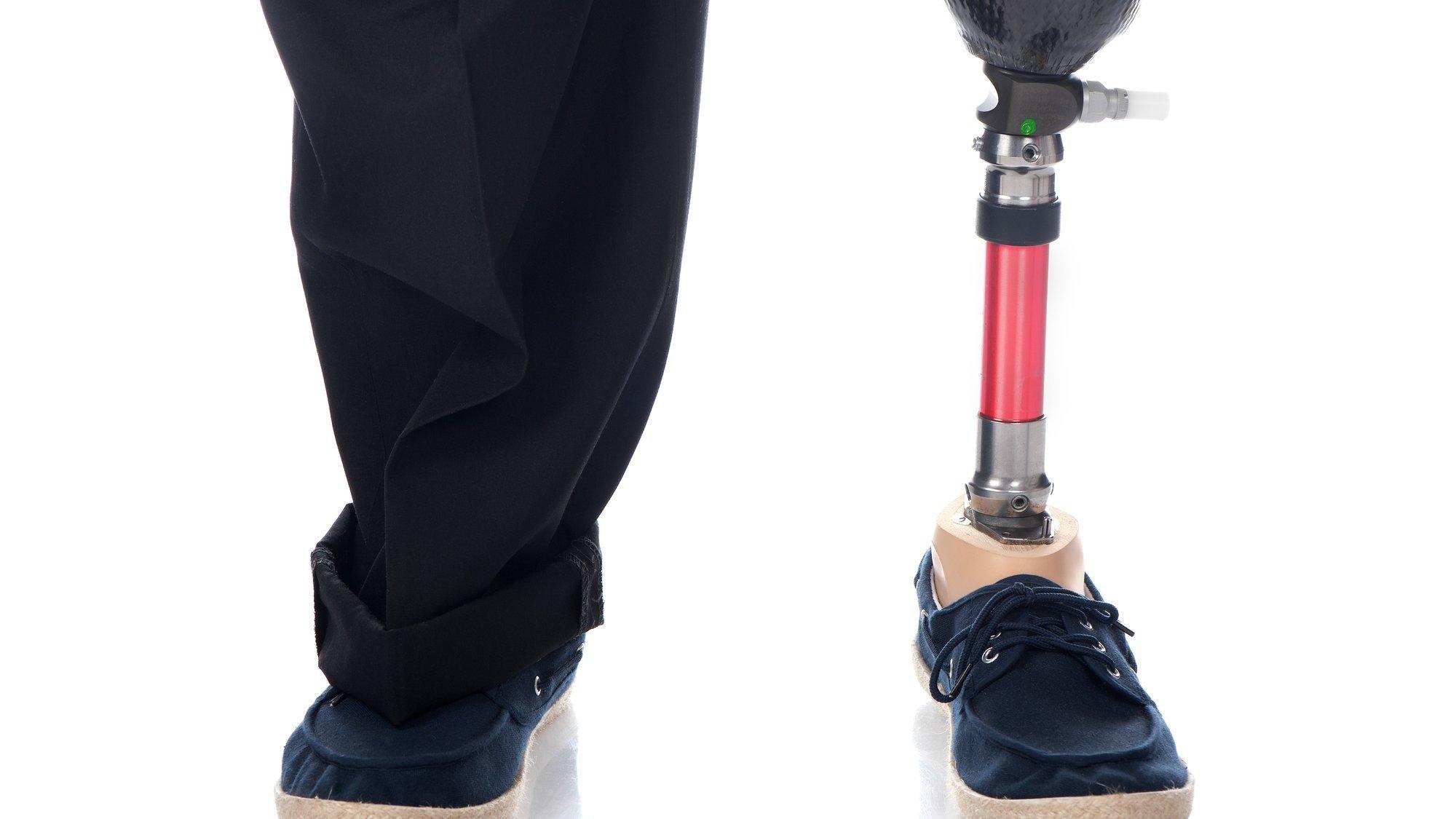 Two legs of an adult man who has a prosthetic lower leg on the left and his healthy leg on the right. Both feet stuck in shoes