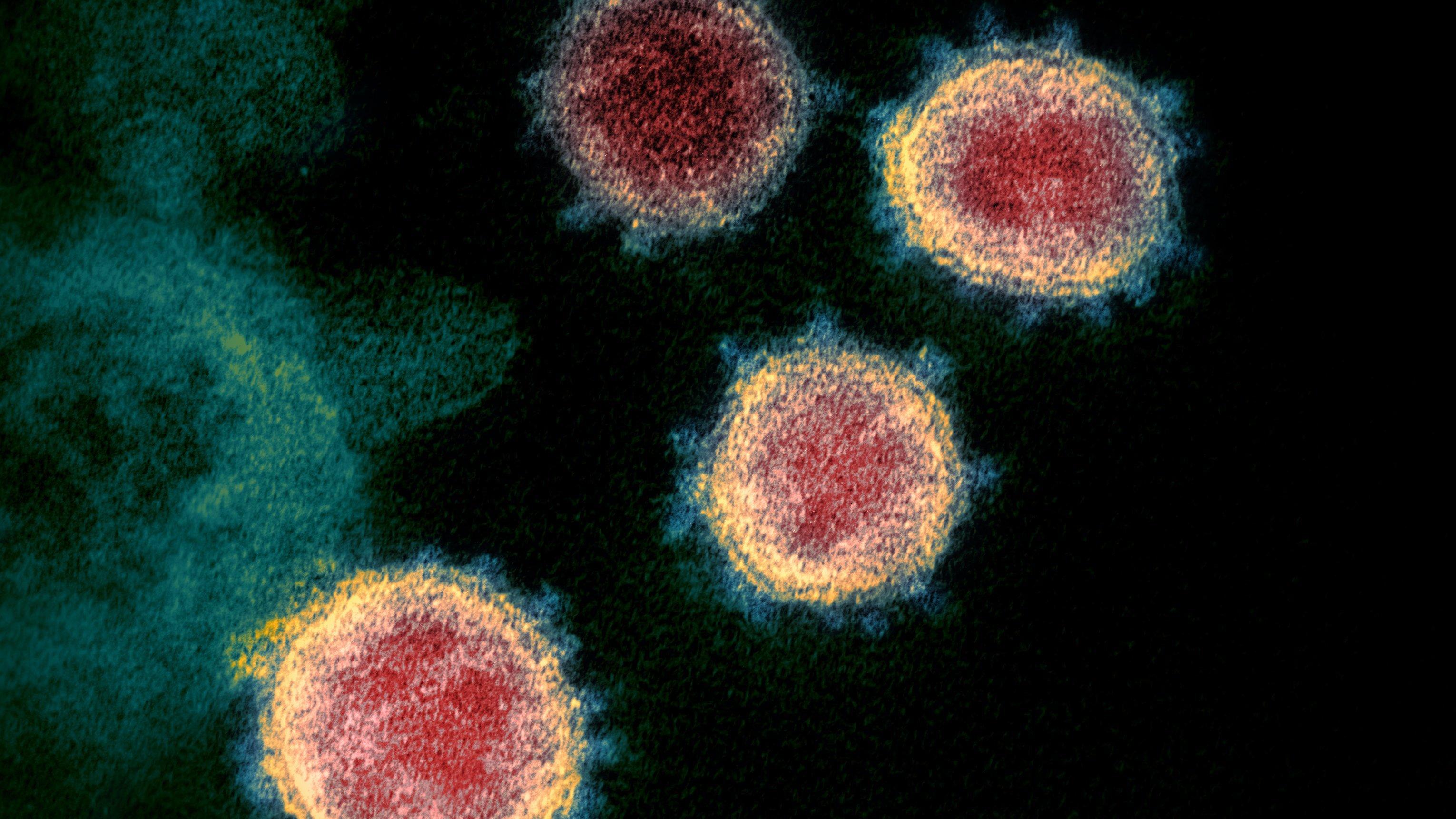 Rotgefärbte Coronaviren mit gelb-grün gefärbten Kronenrand vor schwarzem Hintergrund.