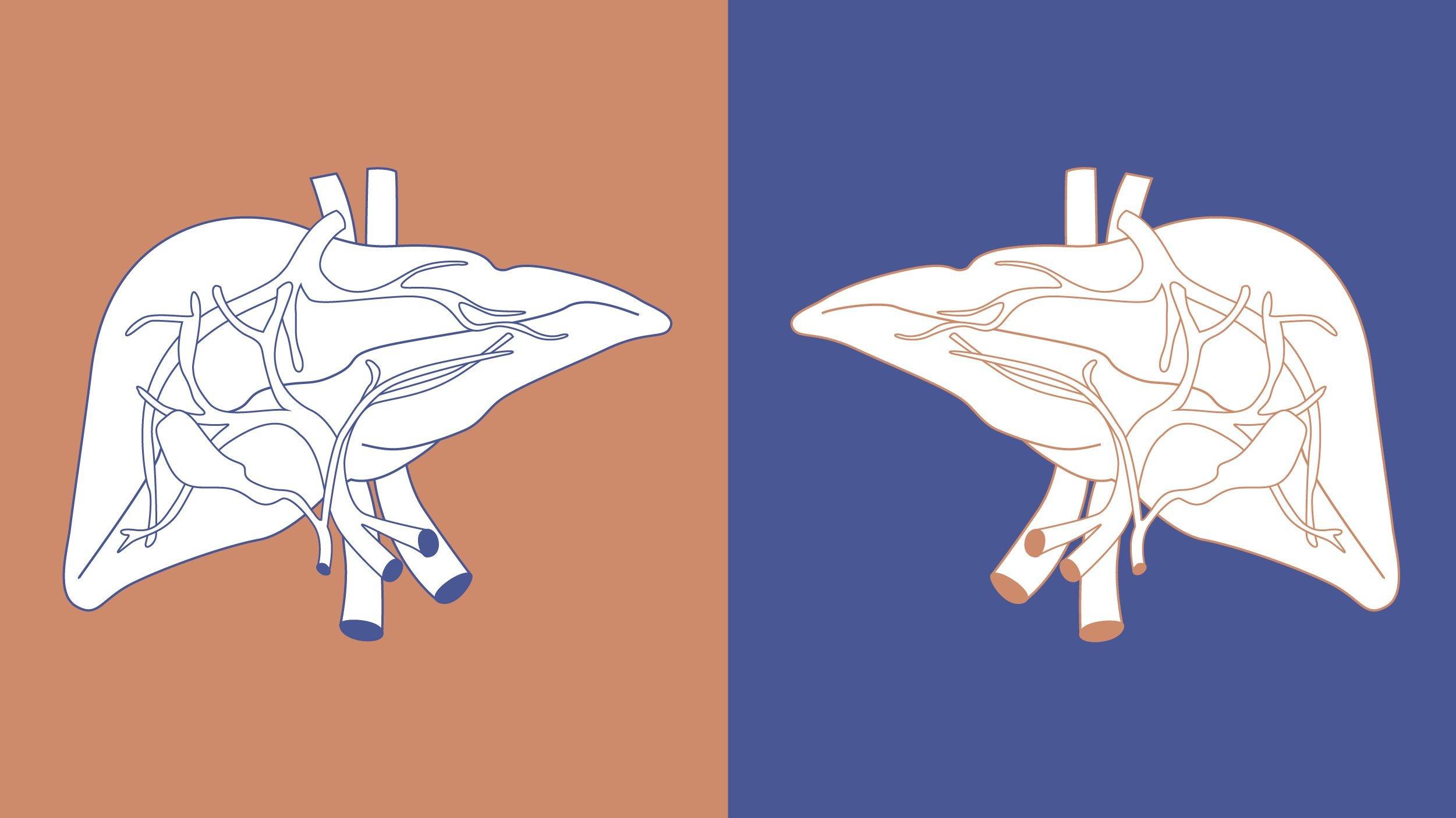 Das Bild ist in eine linke und eine rechte Hälfte geteilt. Links ist eine Zeichnung einer menschlichen Leber vor einem beigen Hintergrund zu sehen. Rechts ist die gleiche Zeichnung spiegelverkehrt vor einem blauen Hintergrund zu sehen.