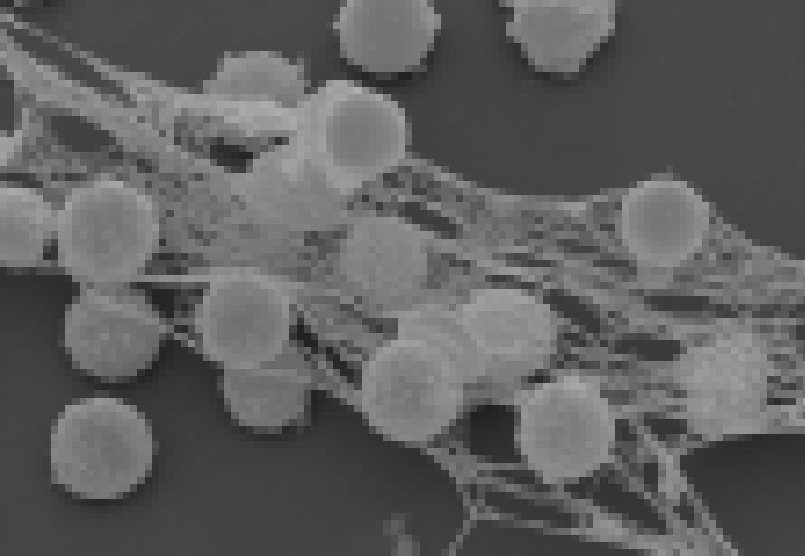 Das Bild zeigt eine rasterelektronenmikroskopische Aufnahme von aktivierten Immunzellen, die durch eine netzartige Struktur miteinander verbunden sind