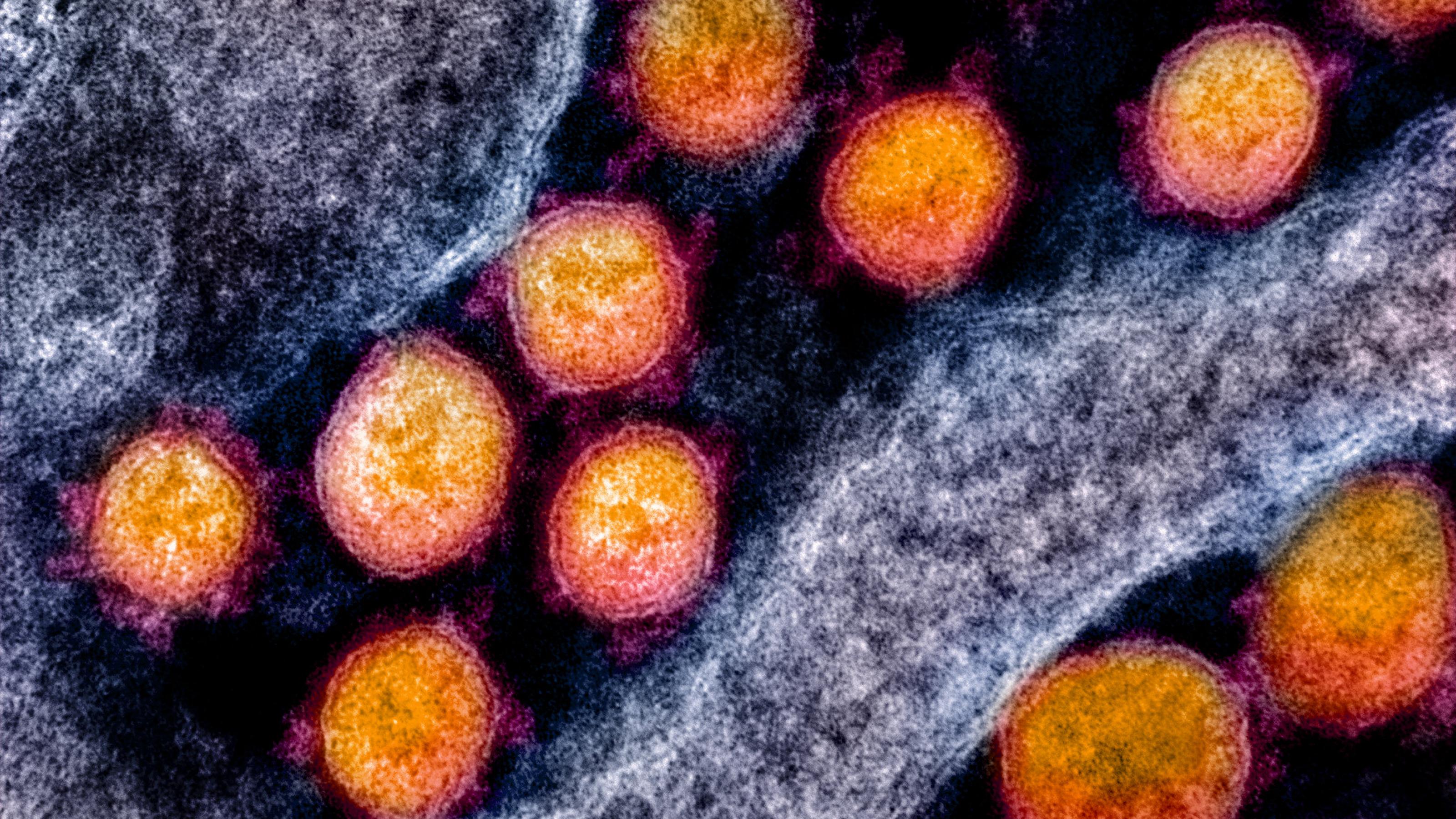 Das Bild zeigt runde Kugeln in einer biologischen Struktur. Die Kugeln sind Aufnahmen von Coronaviren, die Struktur das Gewebe des Körpers.