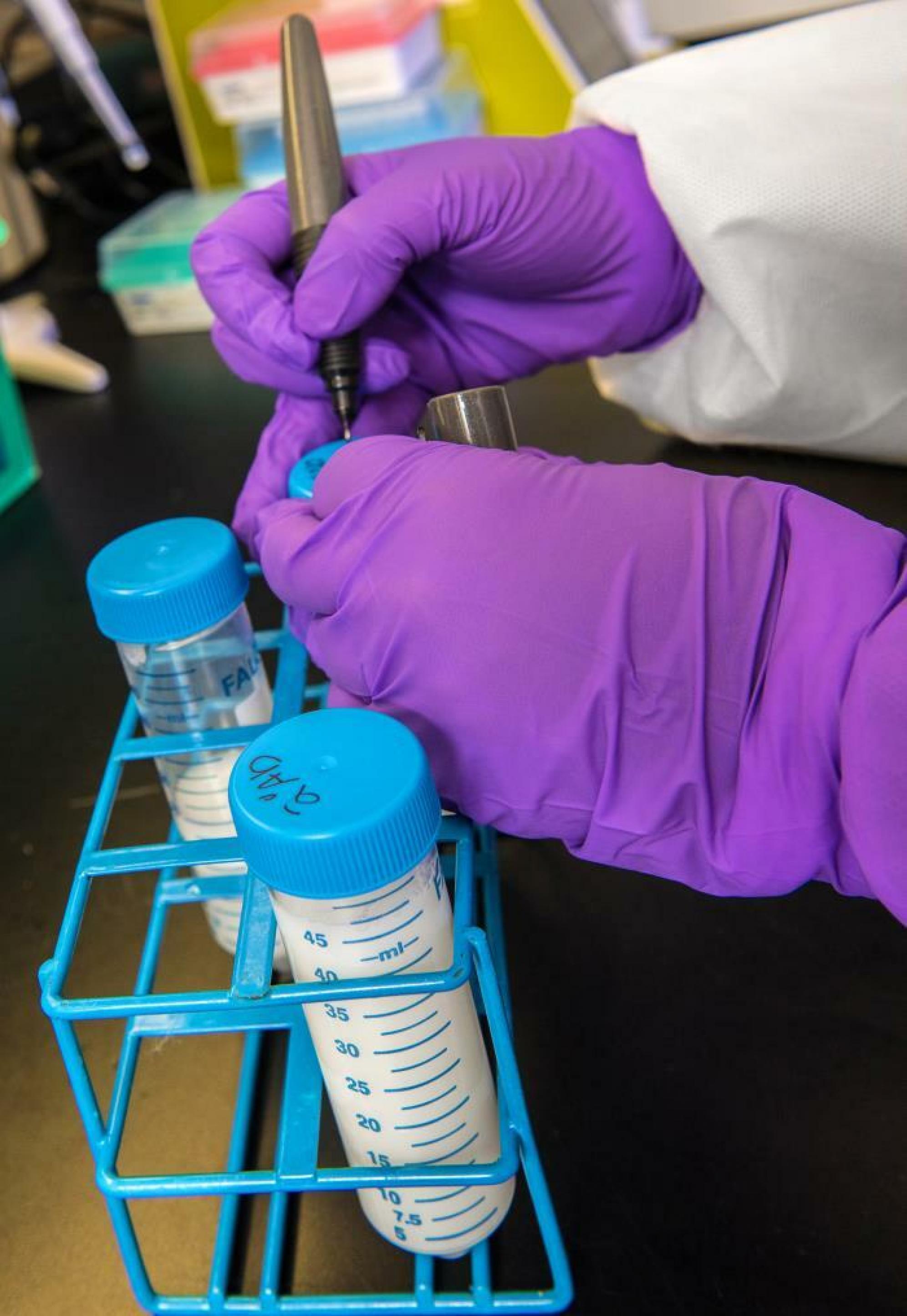 Drei Röhrchen mit Blutplasma werden im Labor auf Antikörperhin untersucht. Man sieht zwei Hände mit lila Handschuhen, die gerade eines der Röhrchen beschriften.