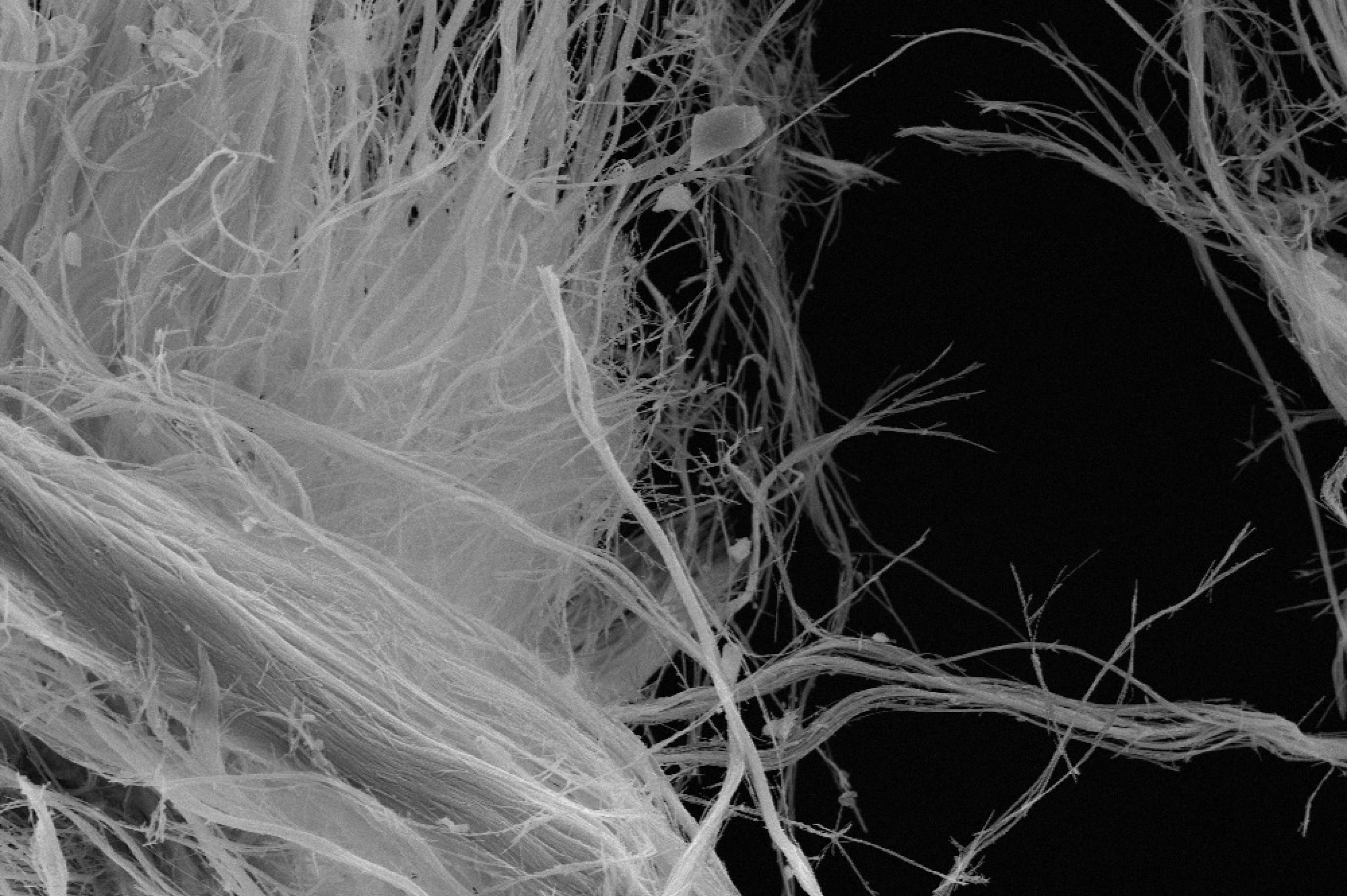 weiße Asbestfasern unter dem Mikroskop