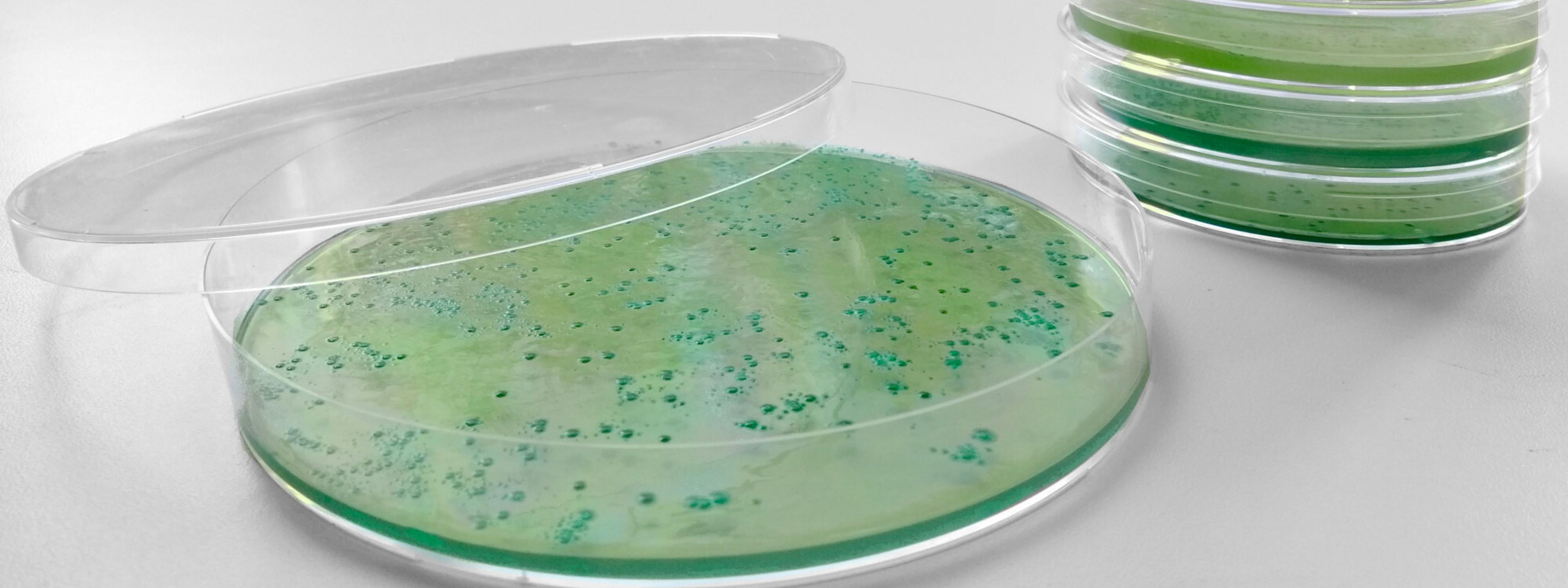 Grünlich-gelber Agar in Petrischalen aus Kunststoff. Auf dem Agar wachsen grübe Bakterienkolonien.