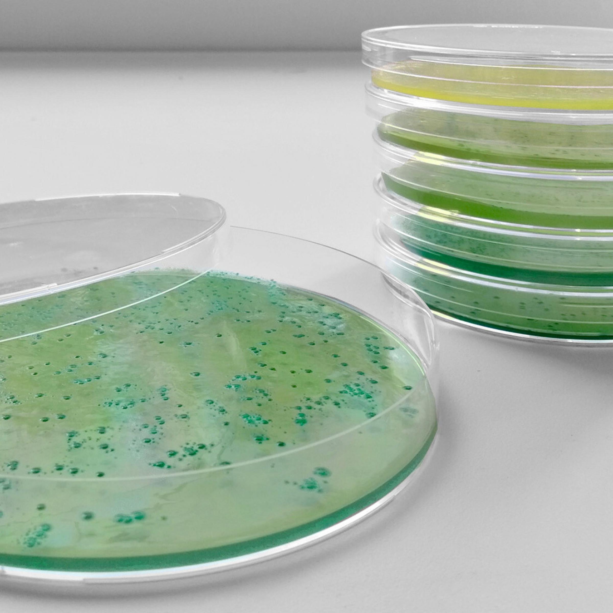 Gelb-grünlicher Agar in Petrischalen aus Kunststoff. Die fordere ist geöffnet, fünf weitere stehen versetzt dahinter aufeinander. Auf dem Agar wachsen grüne Bakterienkolonien.
