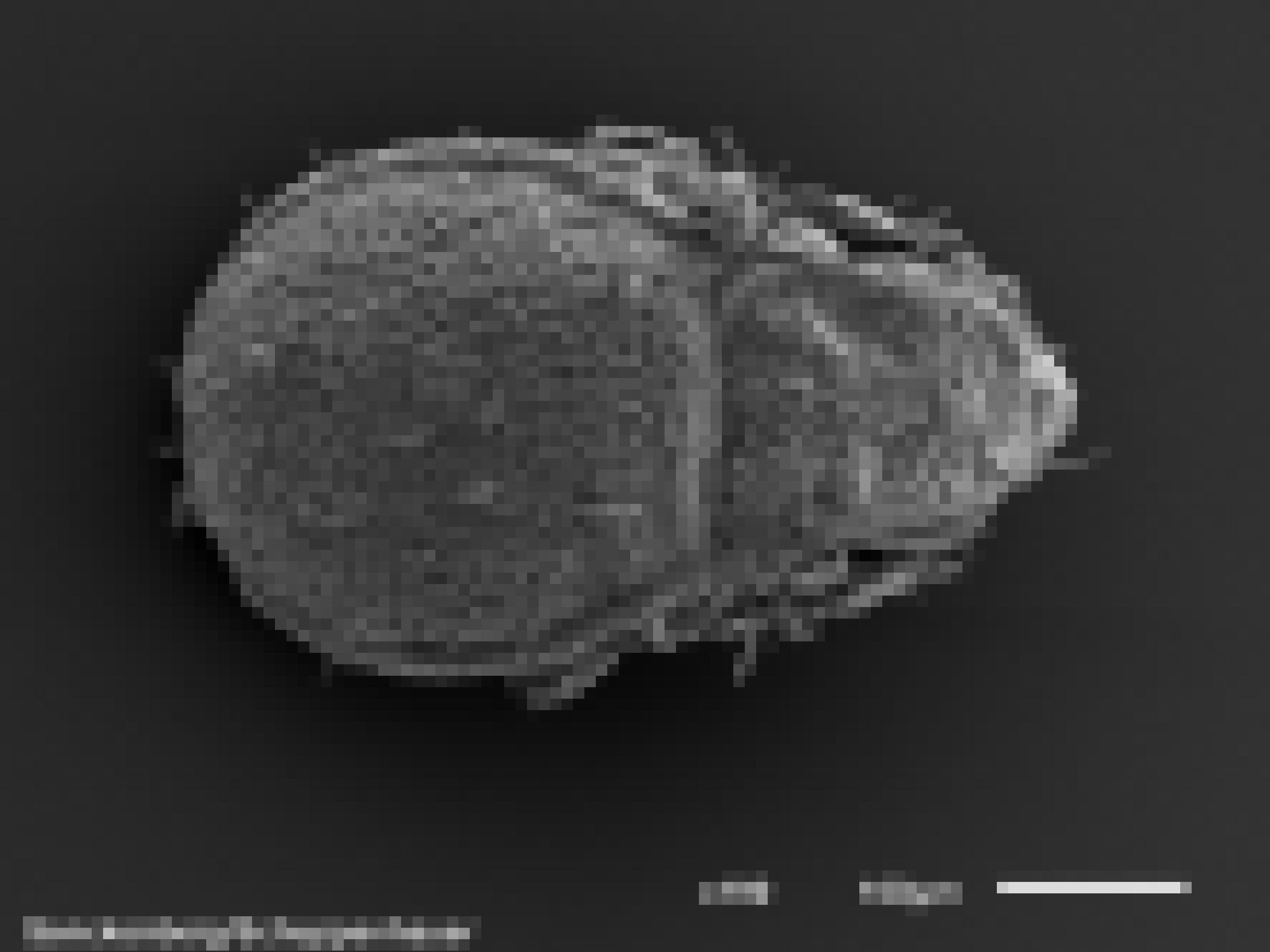 Mikroskopaufnahme eines grauen Tieres mit rundem Hinterteil, dreieckigem Kopf und vielen regelmäßigen Vertiefungen im Panzer vor schwarzem Hintergrund, 190-fache Vergrößerung