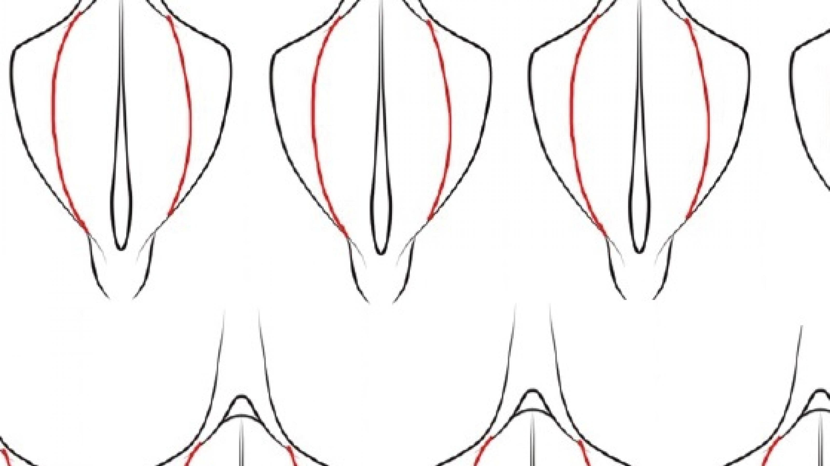 Zu sehen ist die ideale Anatomie der Vulva als intimchirurgische Zeichnung. Diese Zeichnung ist zu einer Collage arrangiert und wiederholt sich ständig ähnlich wie beim Blockdruck.