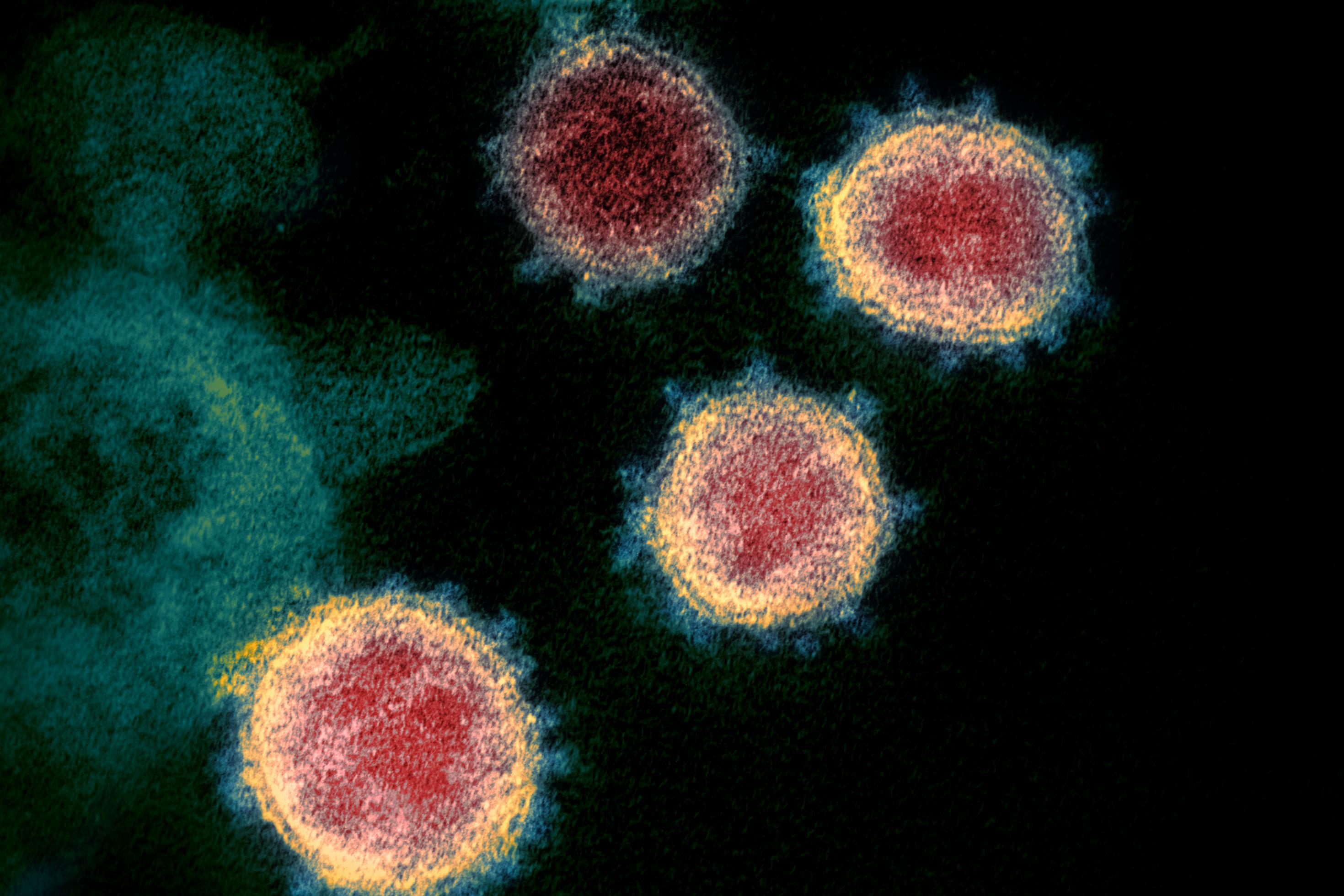 Rotgefärbte Coronaviren mit gelb-grün gefärbten Kronenrand vor schwarzem Hintergrund.