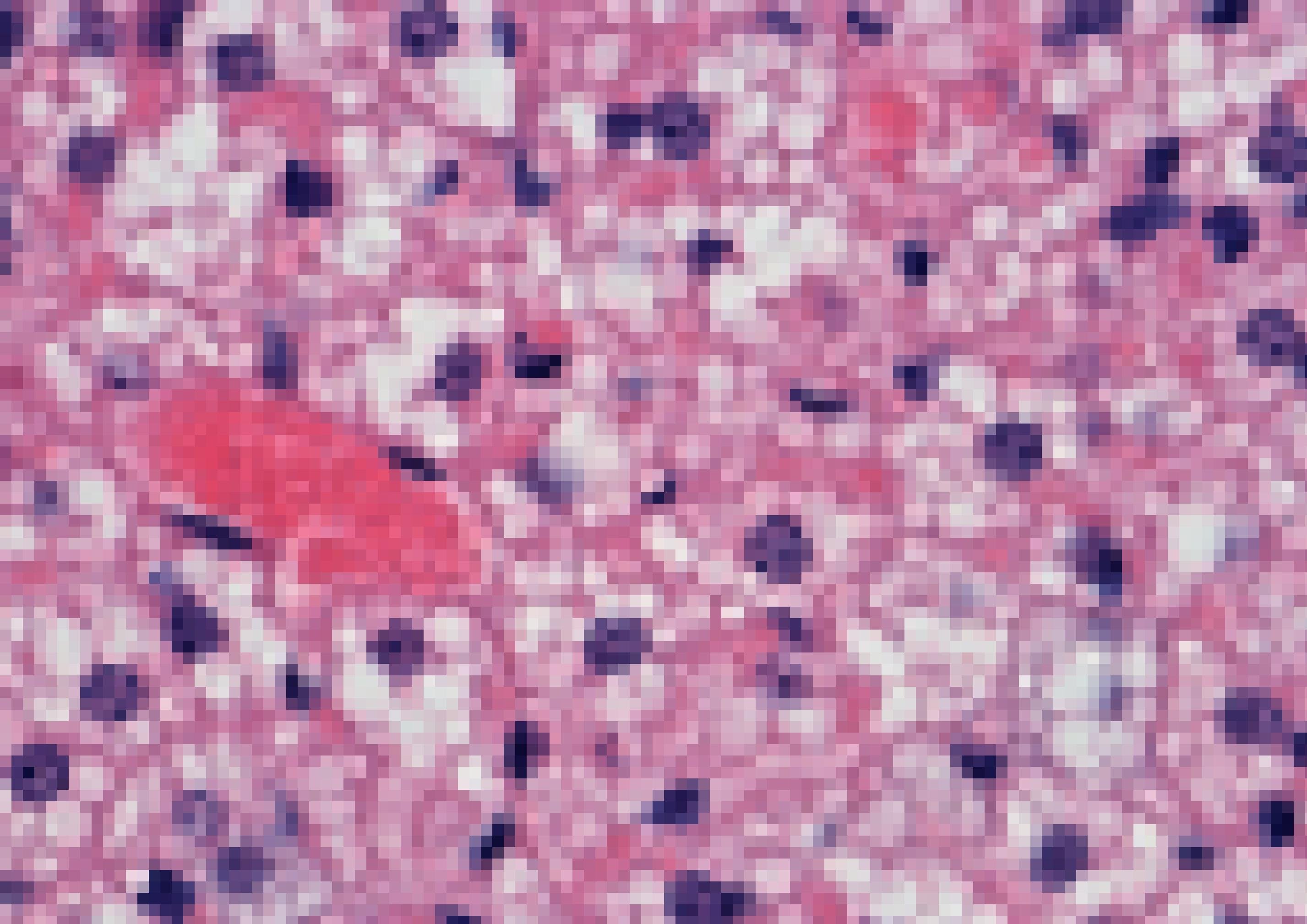 Mikroskopische Aufnahme von Fettgewebe. Das so genannte braune Fettgewebe erscheint wegen einer Anfärbung rosa.