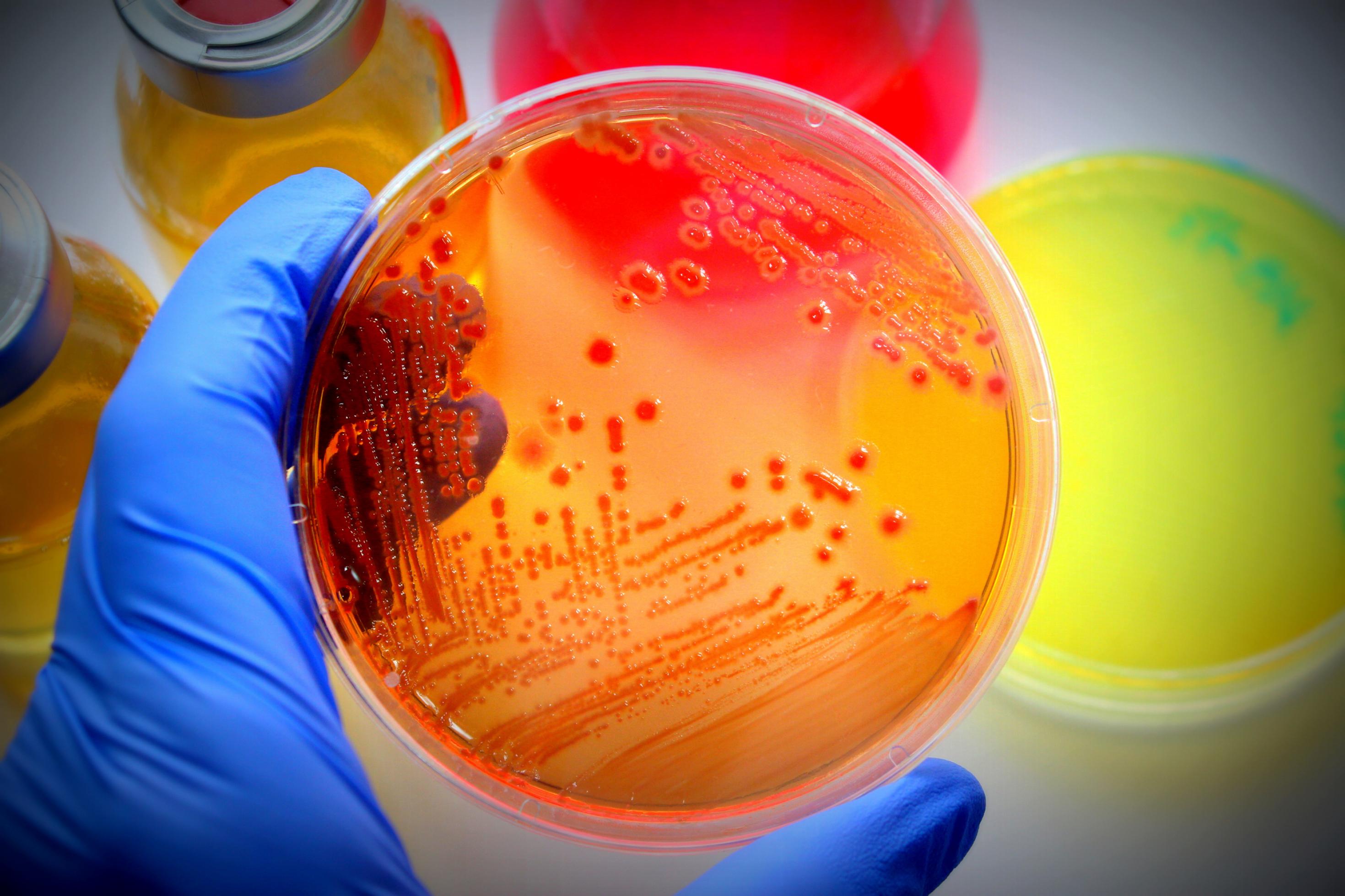 Eine Hand hält eine Petrischale mit E.Coli-Bakterien.