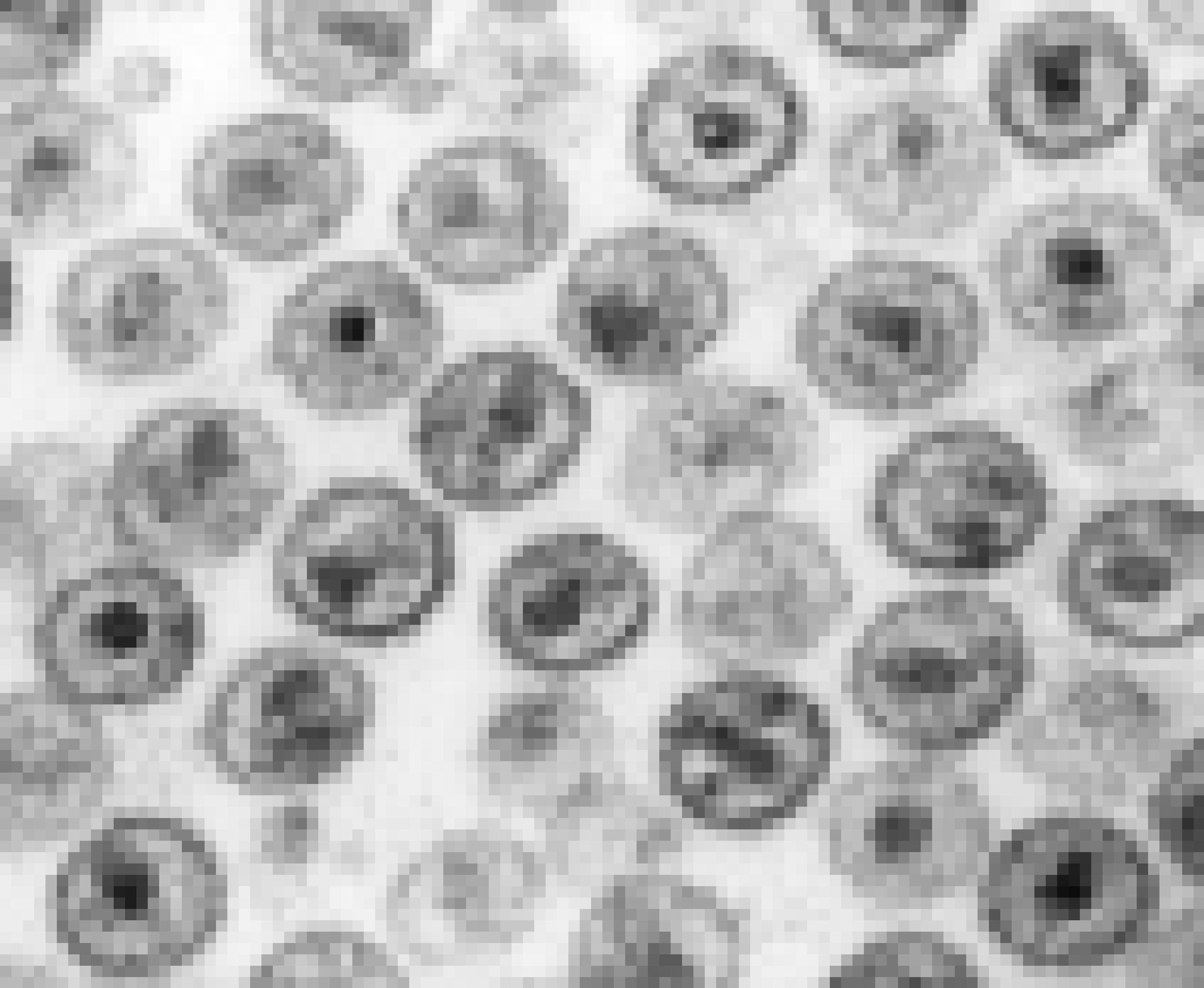 Zu sehen ist eine schwarz-weiß Aufnahme mit vielen runden Gebilden. Diese sind HI-Viren, die unter einem Mikroskop stark vergrößert wurden.