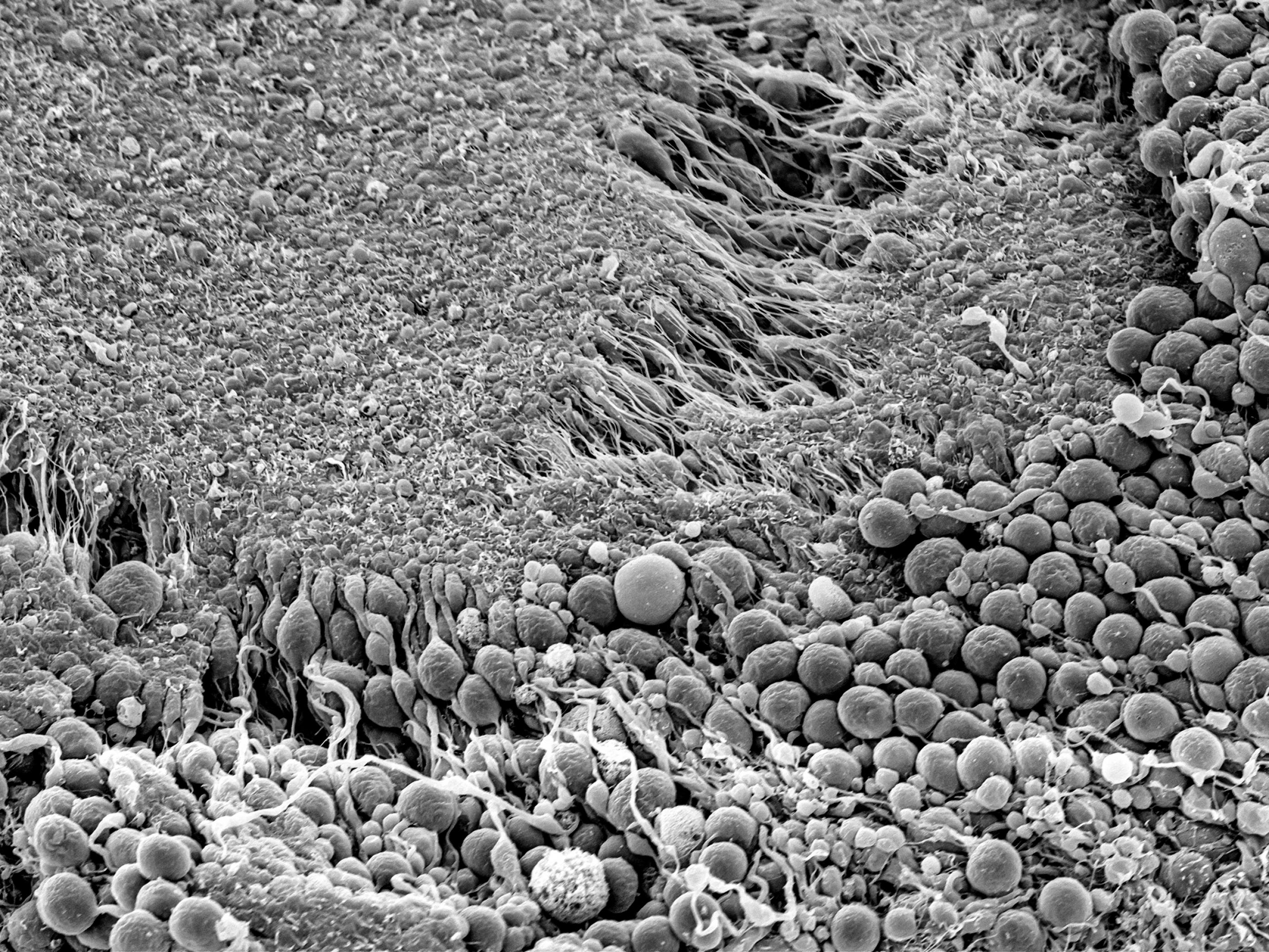 Graues Foto vom Elektronenmikroskop: Eine Aufnahme eines Hirn-Organoids. Man erkennt die geordneten Strukturen, die die Nervenzellen ausbilden.