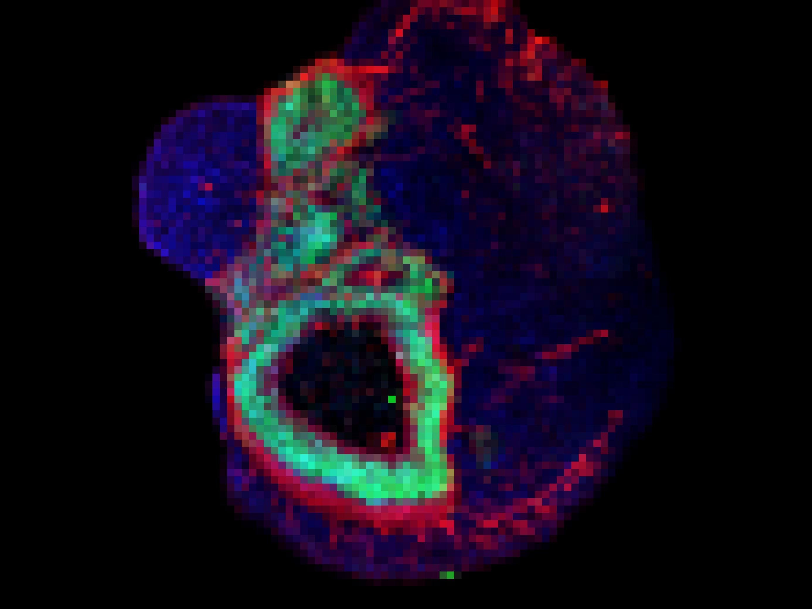 Foto eines Hirn-Organoids. Die verschiedenen Zelltypen des aus Stammzellen gezüchteten Mini-Organs sind unteschiedlich angefärbt.