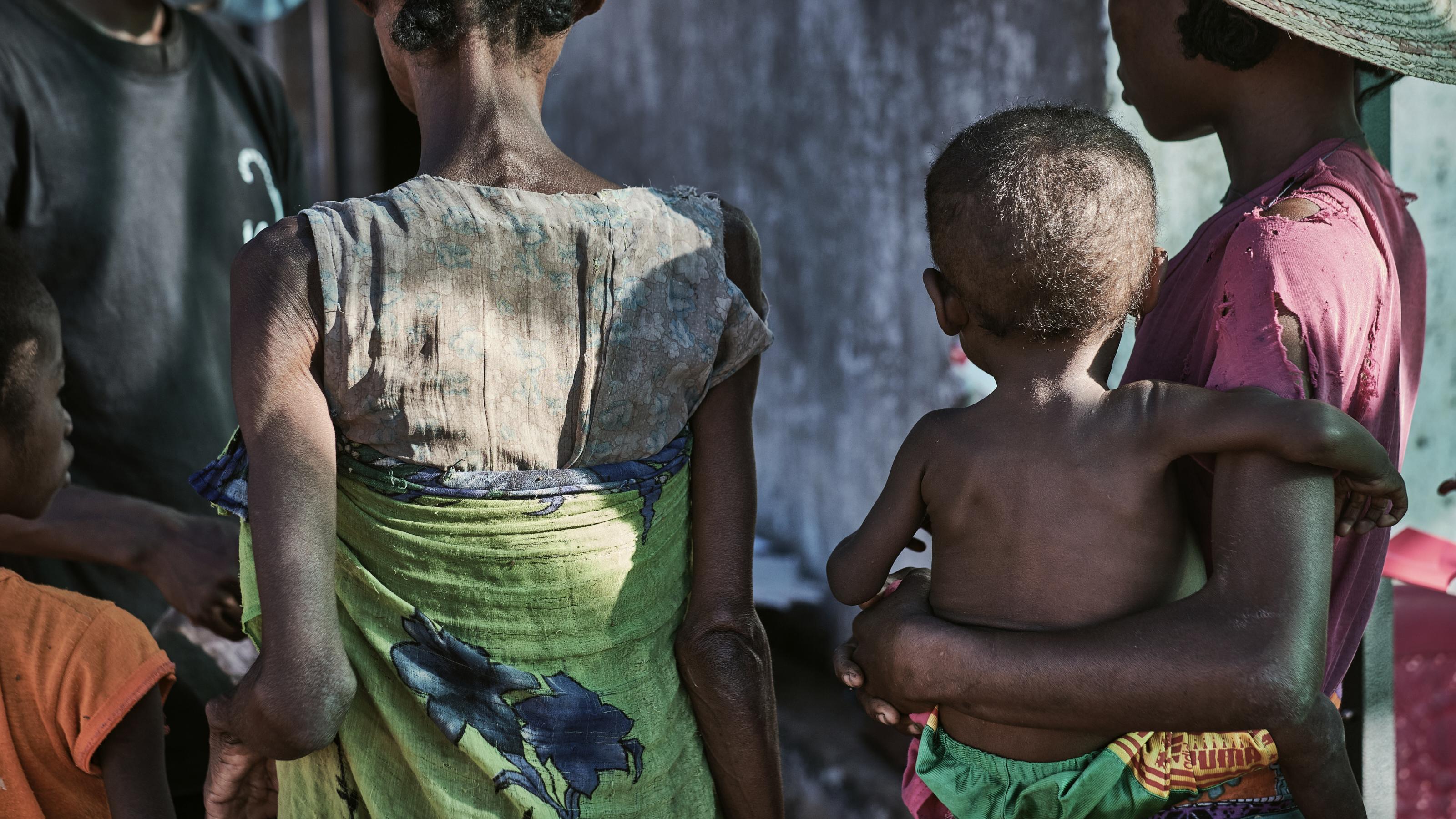 Commune of Ranobe, Amboasary District.
People in the south-east of Madagascar are facing the most acute nutritional and food crisis the region has seen in recent years. MSF began setting up mobile clinics in Amboasary district in late March to screen and treat acute malnutrition in remote villages like those of Ranobe commune, providing ready-to-use therapeutic food and medical care.
It is not only children who suffer from malnutrition, some adults who come to our mobile clinics also suffer from malnutrition.