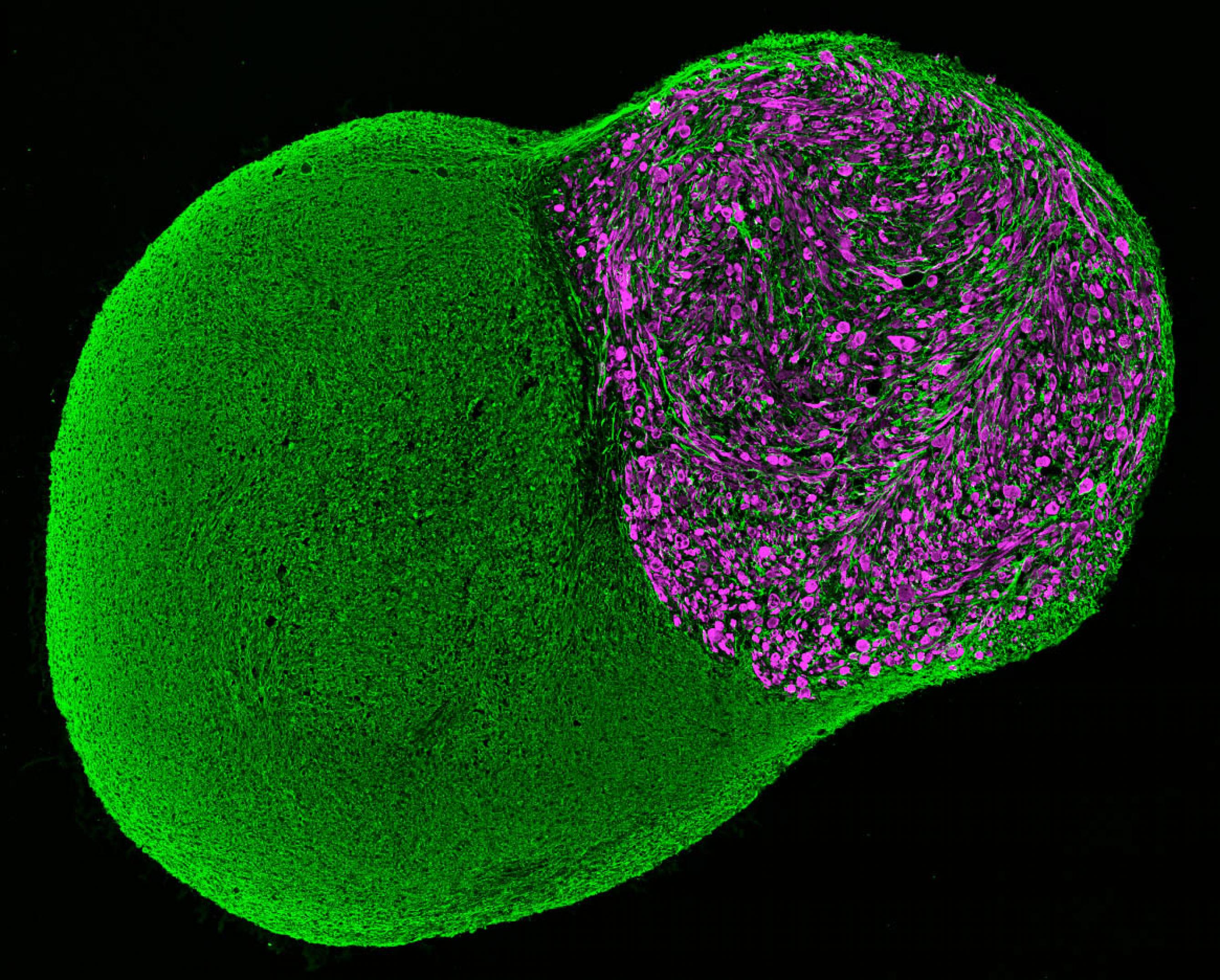 Eine eiförmige kleine Gewebekugel vor dunklem Hintergrund. Die Zellen sind grün und violett angefärbt.