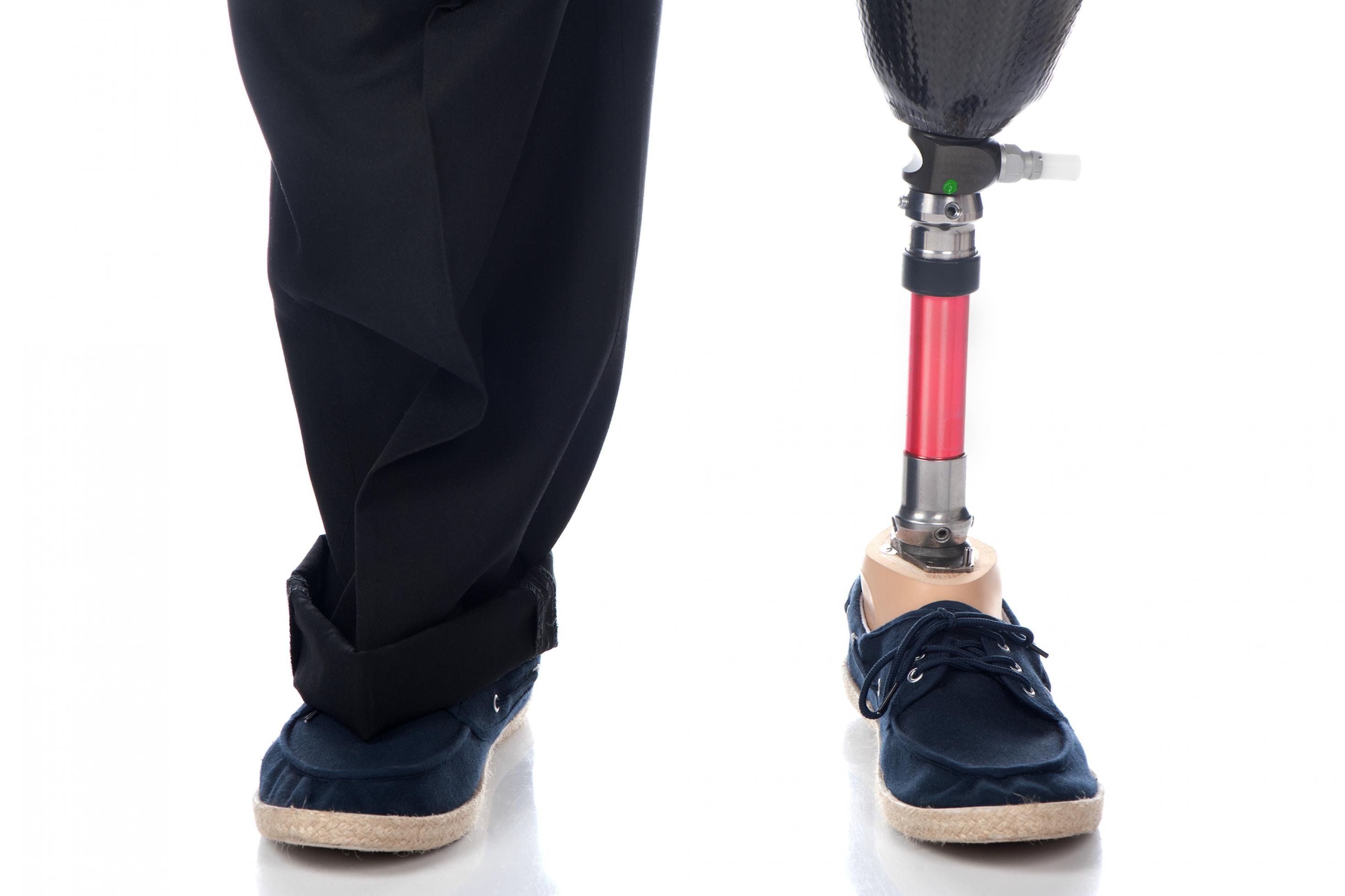 Zwei Beine eines erwachsenen Mannes, der links eine Unterschenkelprothese hat und rechts sein gesundes Bein. Beide Füße stecken im Schuhen.