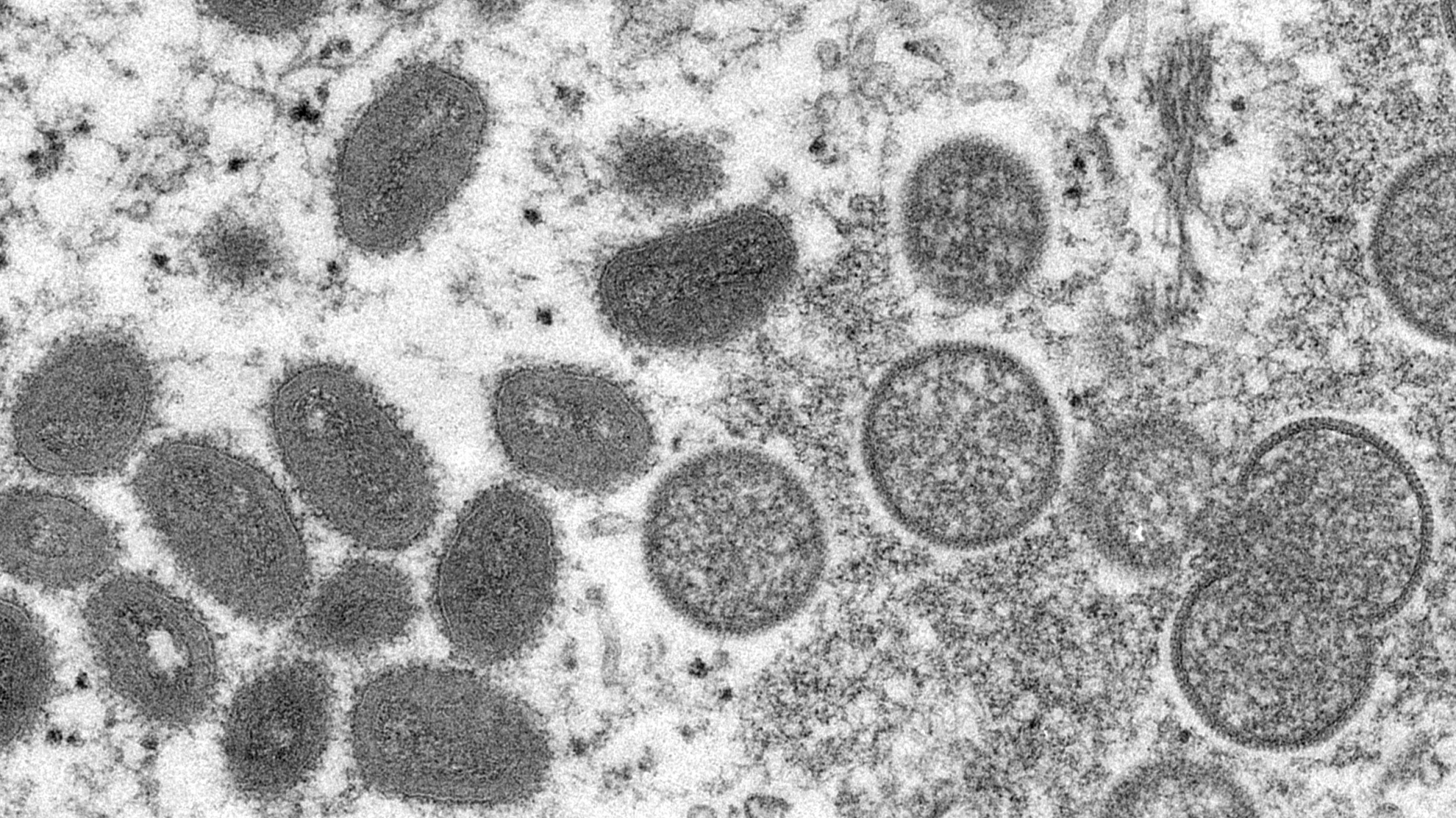 Das ovale Affenpocken-Virus unter dem Elektronenmikroskop