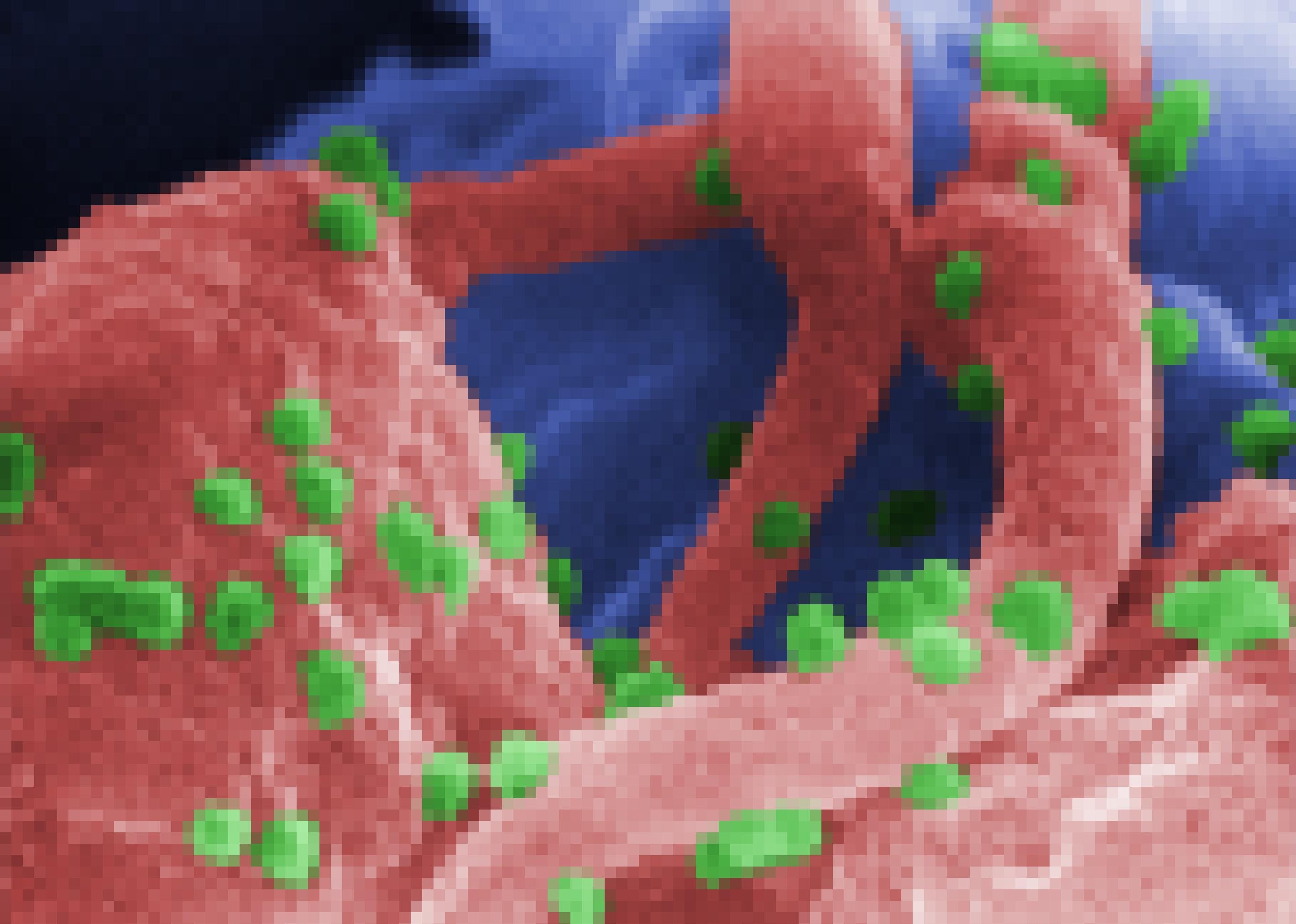 Zu sehen ist die rastermikroskopische Aufnahme von rötlich eingefärbten Abwehrzellen, auf denen grün gefärbte, kleine runde Aidsviren lagern. Die Aidsviren kennen eine besondere Strategie des Überlebens: Sie bringen die Zelle dazu, Kopien der Virus-Erbsubstanz in ihr eigenes Erbgut einzuschleusen. So können die Viren jahrelang ruhen, bis sie sich eines Tages massenhaft vermehren und die Immunschwäche ausbricht.