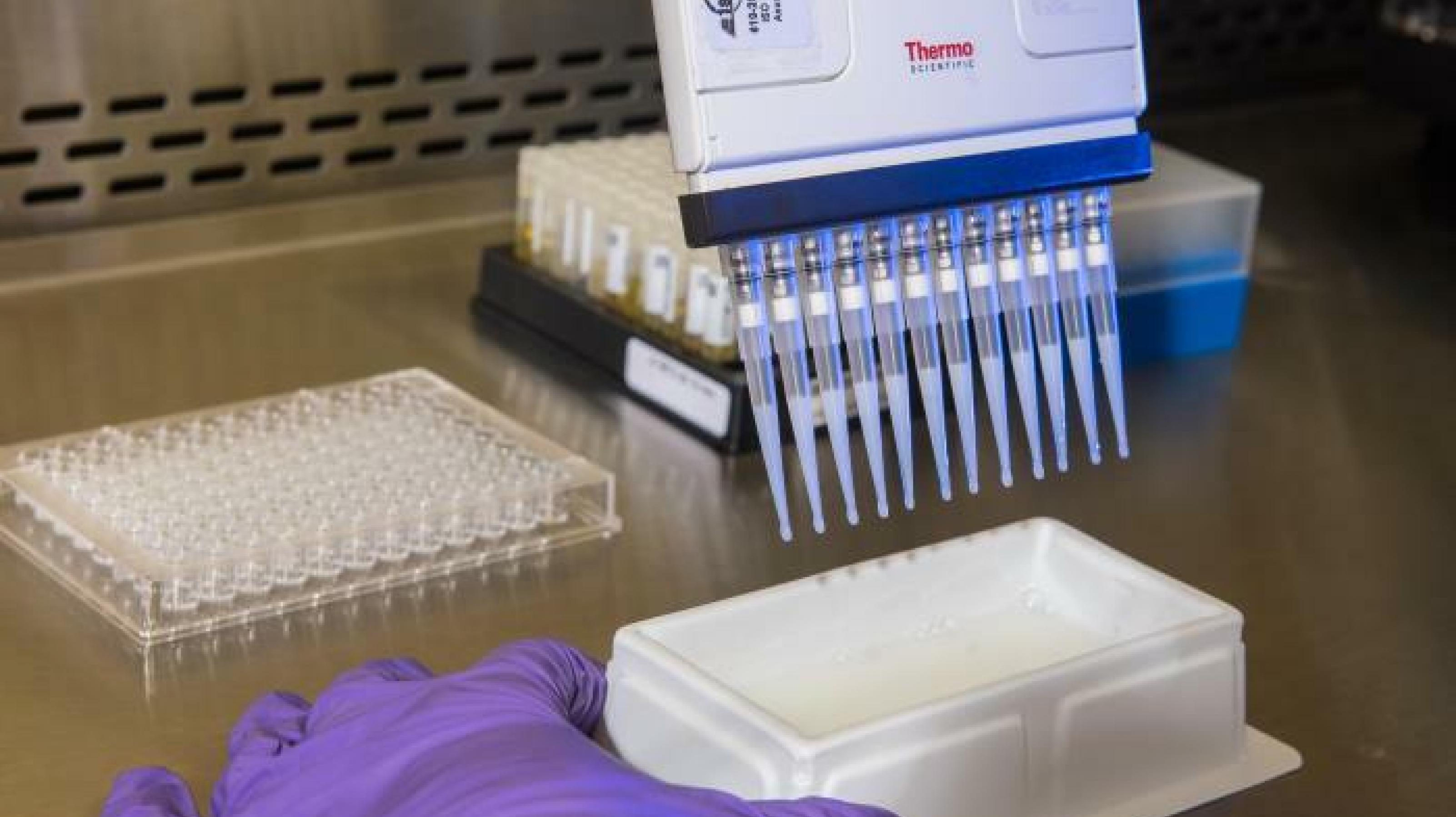 Mit Hilfe einer Pipette wird in einem Labor unter sterilen Bedingungen ein Test auf Antikörper gegen das neue Coronavirus durchgeführt. Zu sehen eine Multipette, mit der kleine Mengen eines Testreagenz in die Probengefäße gegeben werden können.