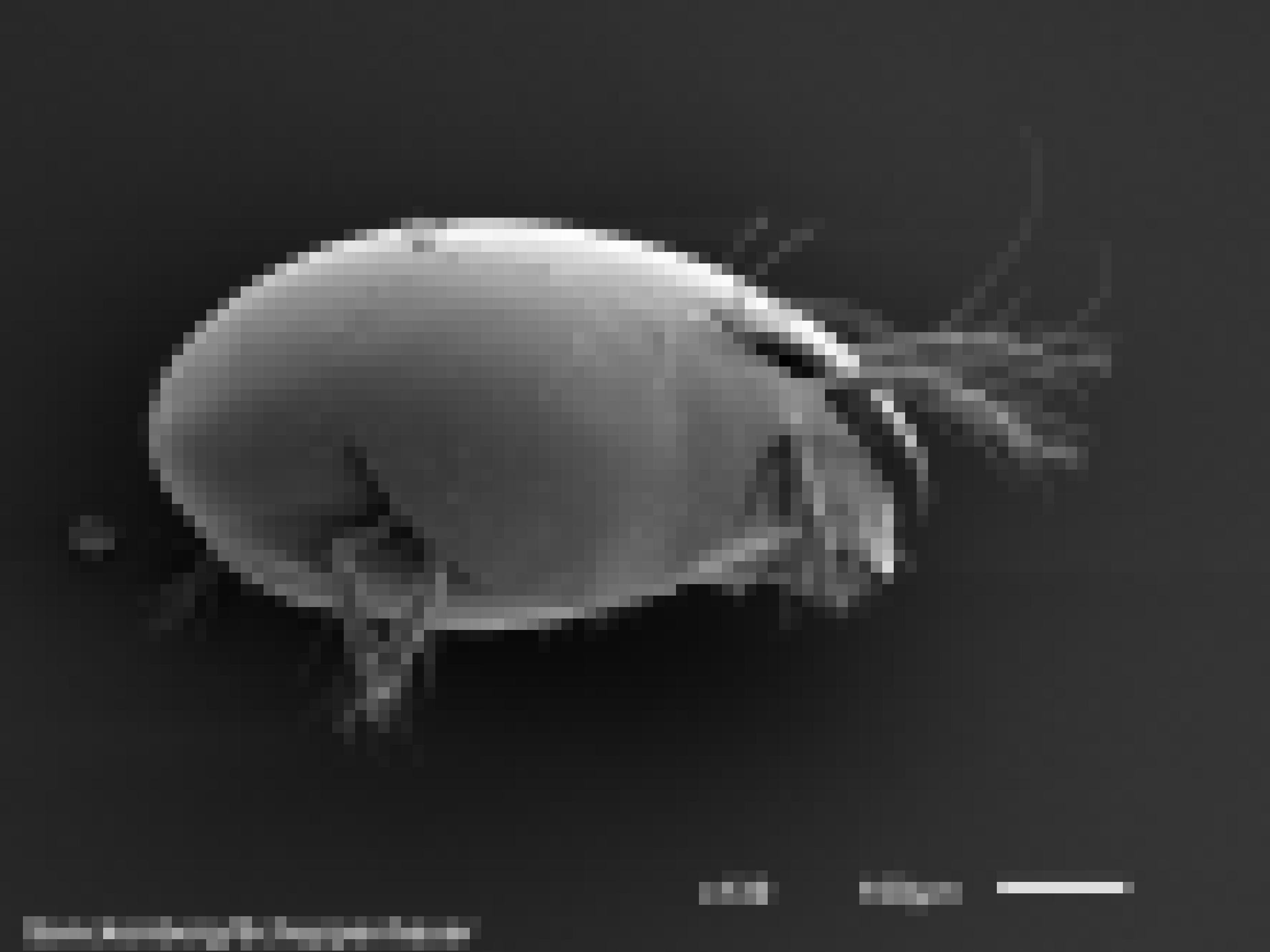 Mikroskopbild eines grauen Tieres, das aussieht wir ein Ei mit Falten, aus denen Beine und Fühler ragen vor schwarzem Hintergrund, 130-fach vergrößert.
