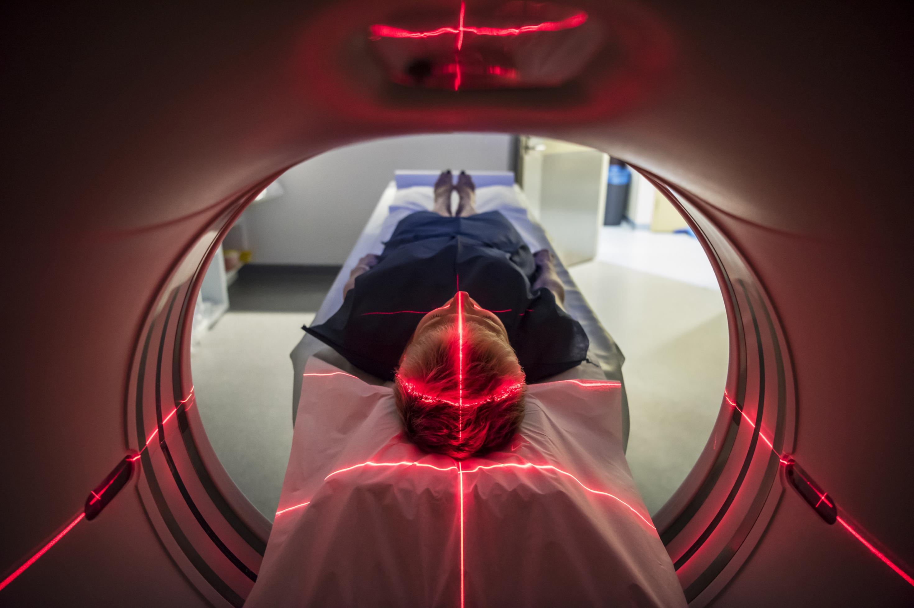 Blick durch die Röhre eines Magnetresonanztomografen auf den Kopf eines Patienten.