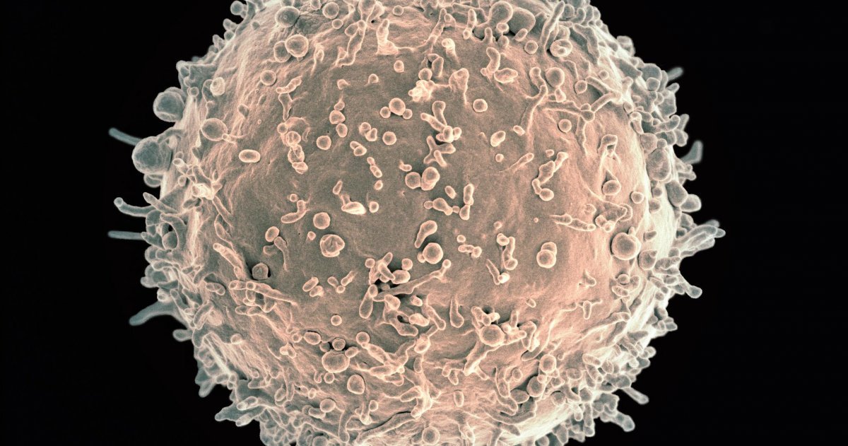 Current reports from infection | and immune research