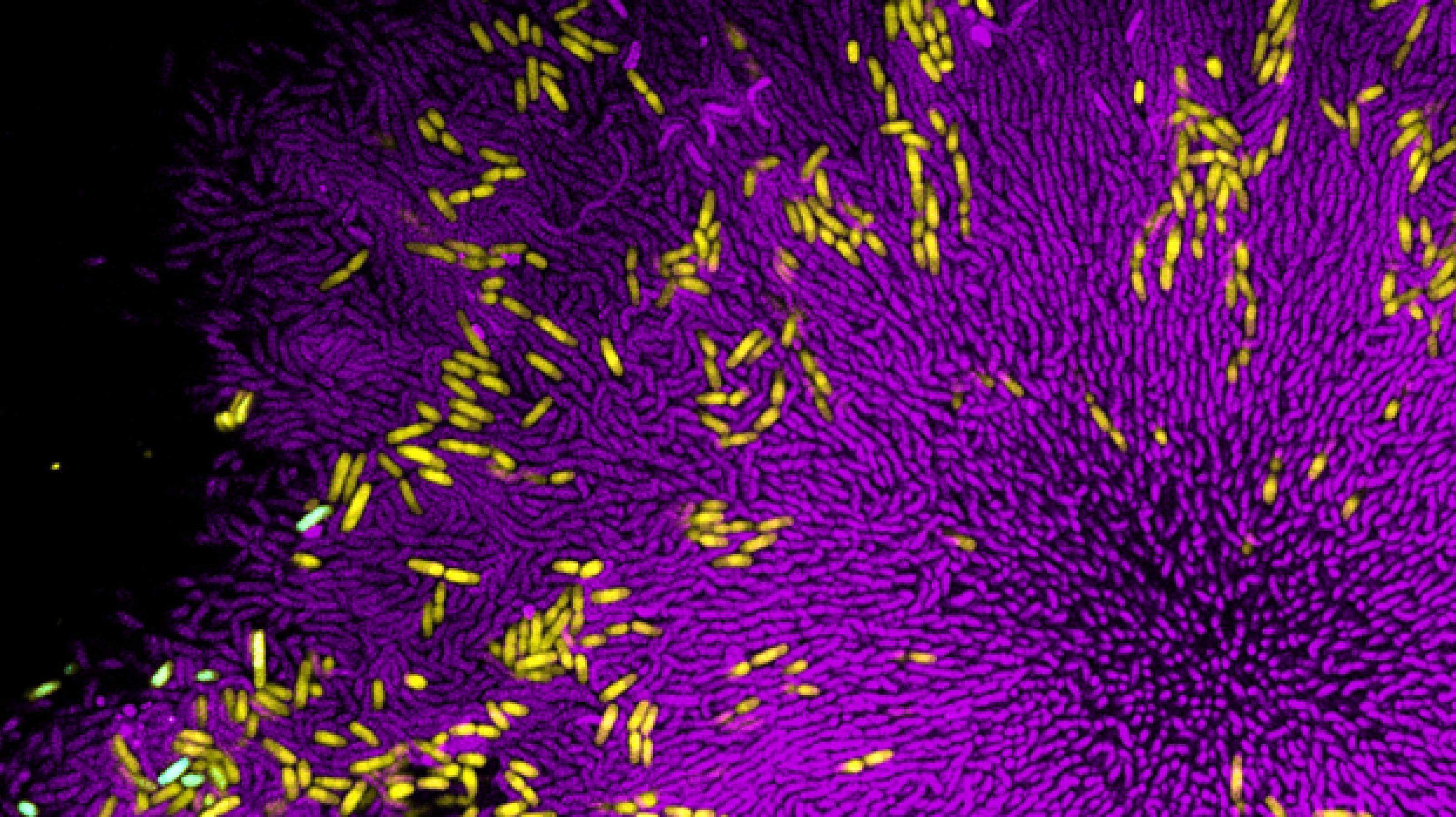 Mikroskopische Aufnahme eine bakteriellen Biofilms, bei dem nur einzelne, kräftig gefärbte Mikroben zu erkennen sind. Gelbe Colibakterien sind verstreut auf einem Rasen aus lila Cholera-Erregern.