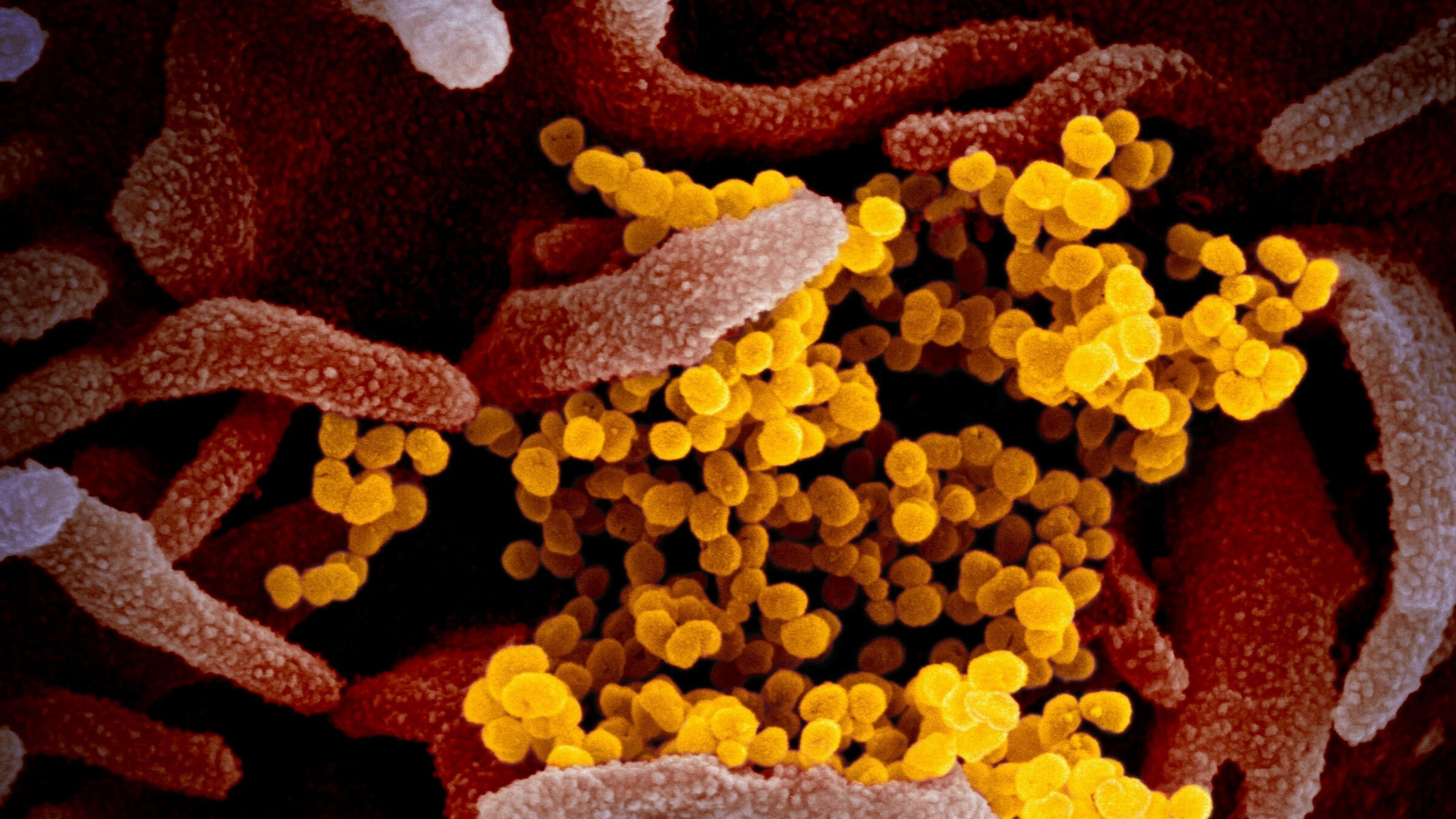 Coronavirus unter dem Mikroskop. Die Wissenschaft sucht eine Strategie gegen Covid-19 und andere Viren.