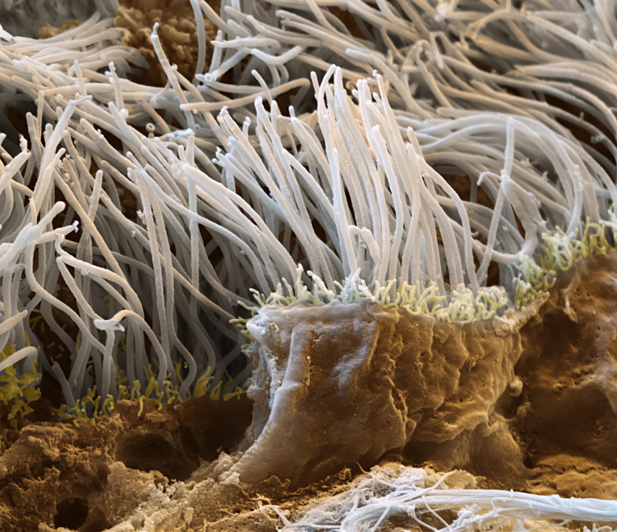 Das Bild zeigt einen Bruch durch das Gewebe der Flimmerepithelien der Lunge (Tunica mucosa). Diese Flimmerepithelien kleiden die gesamten Bronchien der Lunge aus. Die Cilien dieser Zellen schlagen ständig in Richtung der Luftröhre und transportieren eingeatmete Schmutzpartikel, zusammen mit abgesondertem Schleim, aus der Lunge heraus. (Probe: Schwein)
Raster-Elektronenmikroskop, Vergrösserung   12 000:1  (bei 15×13cm Bildgrösse)