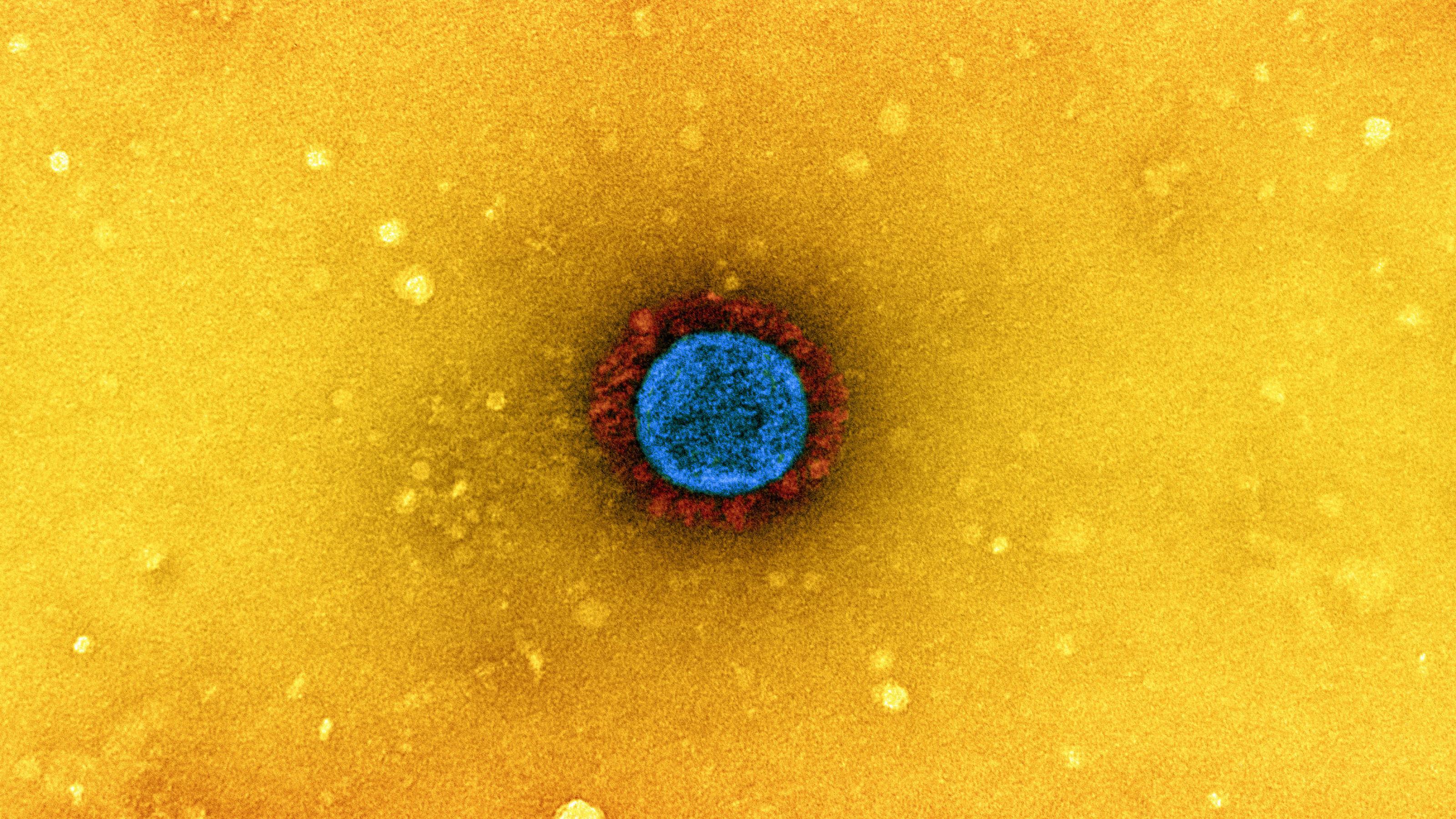 Elektronenmikroskopische Aufnahme von Sars-CoV-2. Das Virus ist blau angefärbt, die Spike-Proteine rot.
