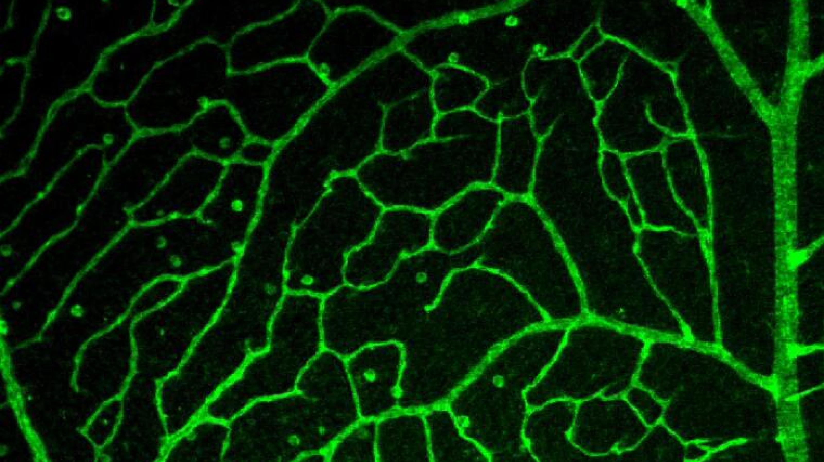 Mit leuchtend grünem Fluoreszenzfarbstoff angefärbte, verzweigte Blutgefäße in der Netzhaut