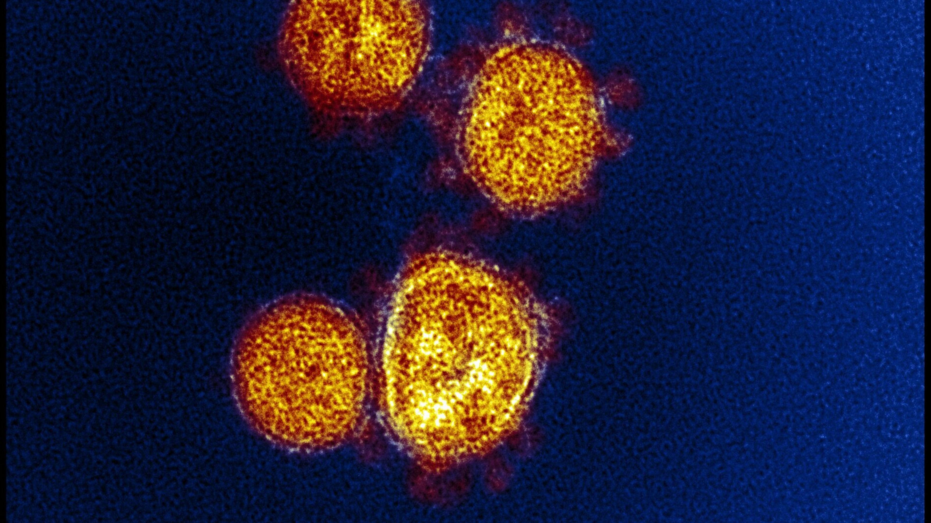 Elektronenmikroskopische Aufnahme von Sars-CoV-2, Viruspartikel gelb, Spikeproteine rot vor blauem Hintergrund.
