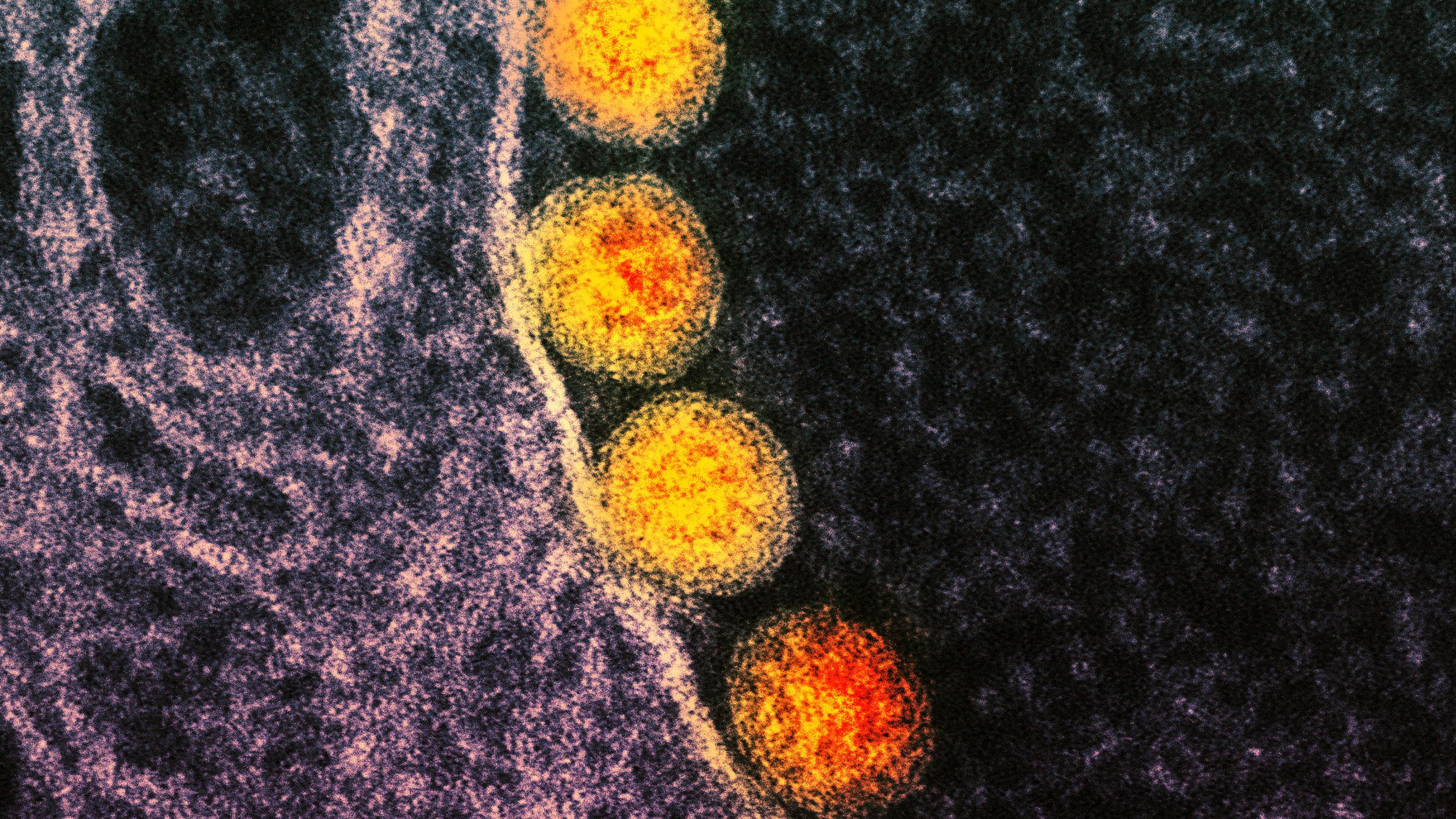 Gelb gefärbte Coronaviren in einer Aufnahme mit dem Elektronenmikroskop.