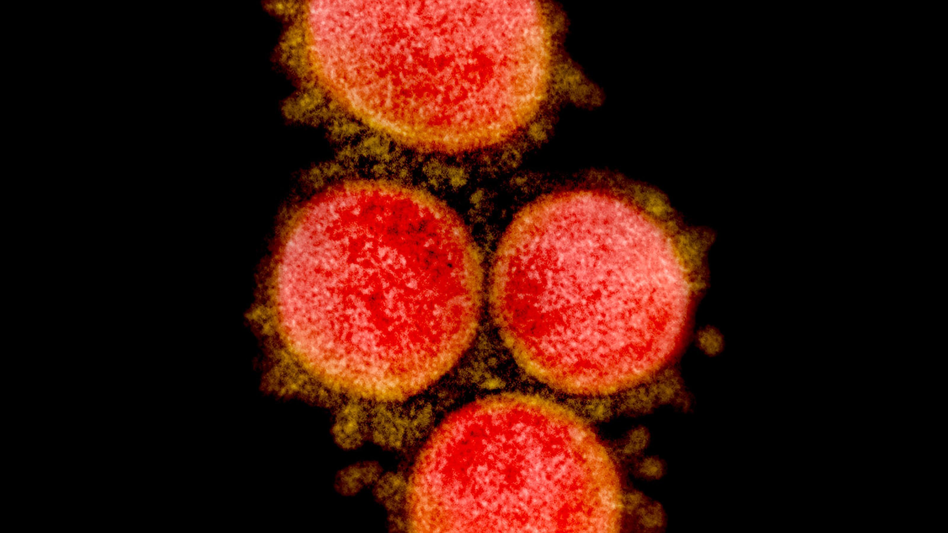 Das Bild zeigt eine elektronenmikroskopische Aufnahme von Sars-CoV-2. Die Viruspartikel sind rot angefärbt.