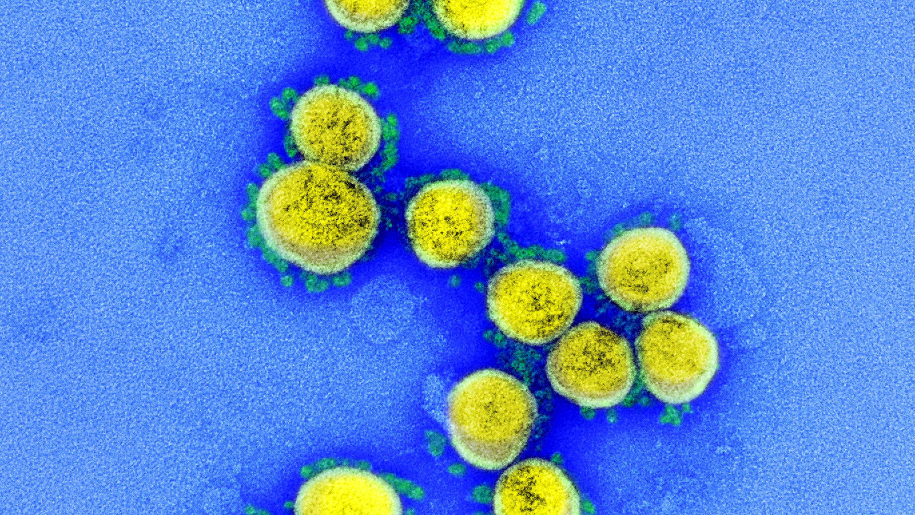 Das Foto zeigt eine elektronenmikroskopische Aufnahme des Coronavirus Sars-CoV-2. Das Virus ist gelb, seine Stacheln grün angefärbt.