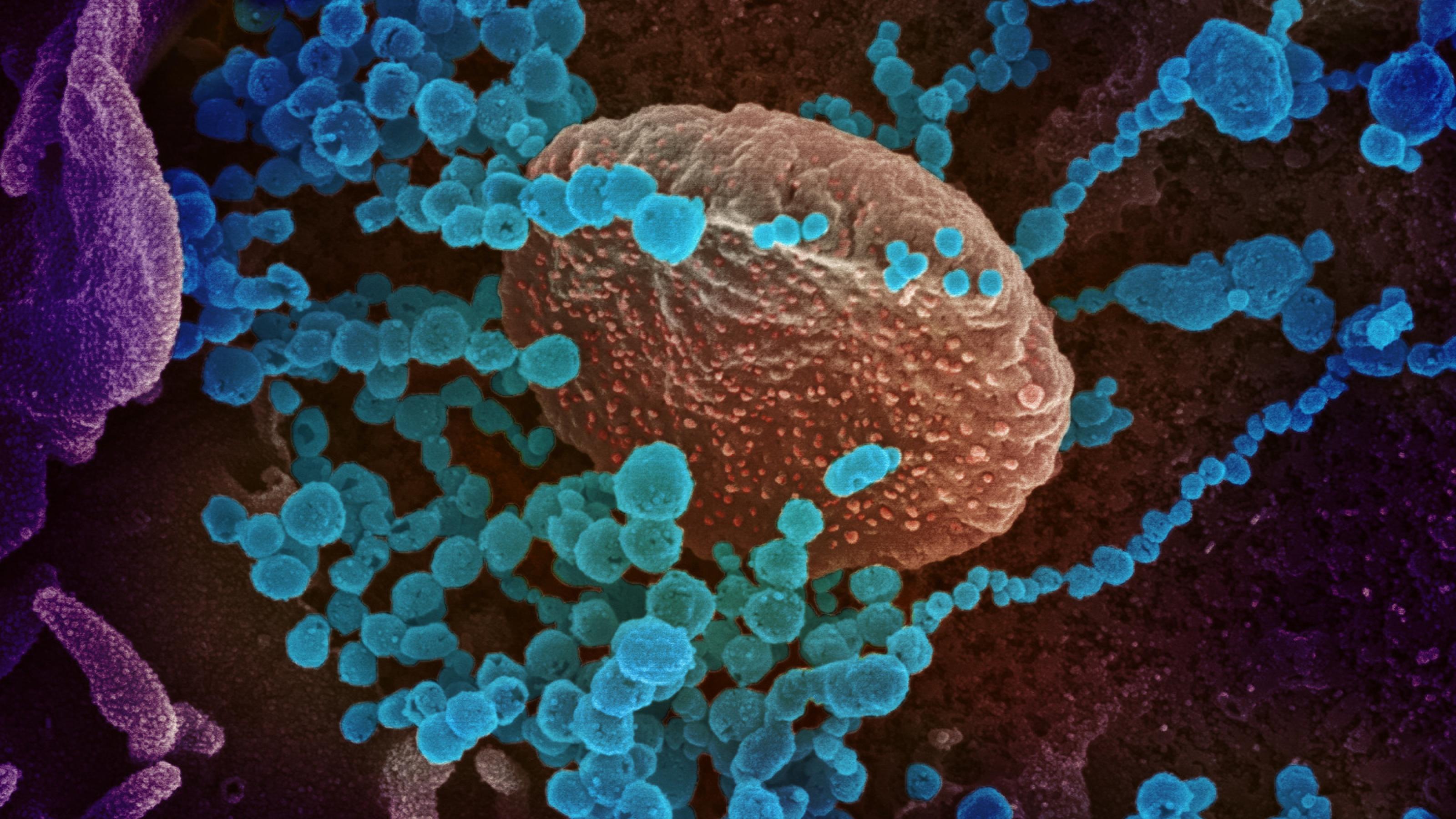 Ein Blick durch ein Elektronenmikroskop auf das Corona-Virus.