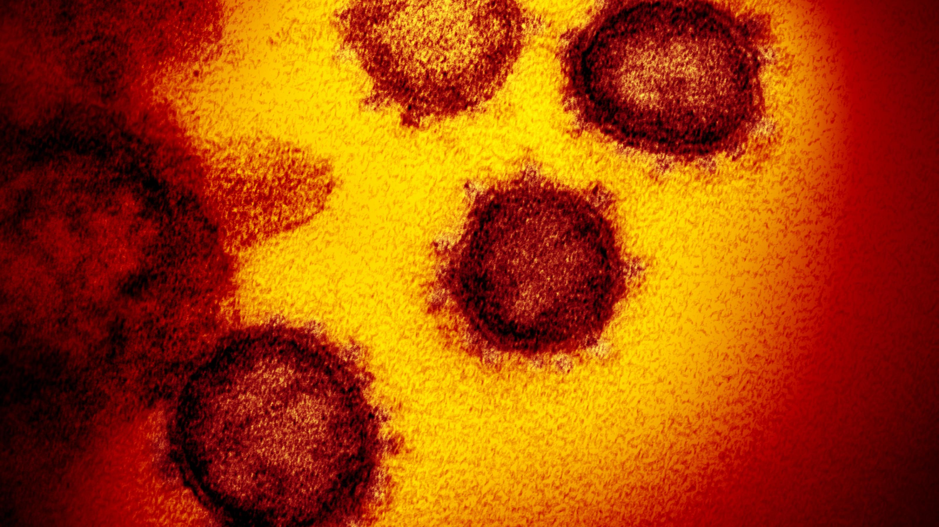 Ein Corona-Virus unter dem Elektronenmikroskop