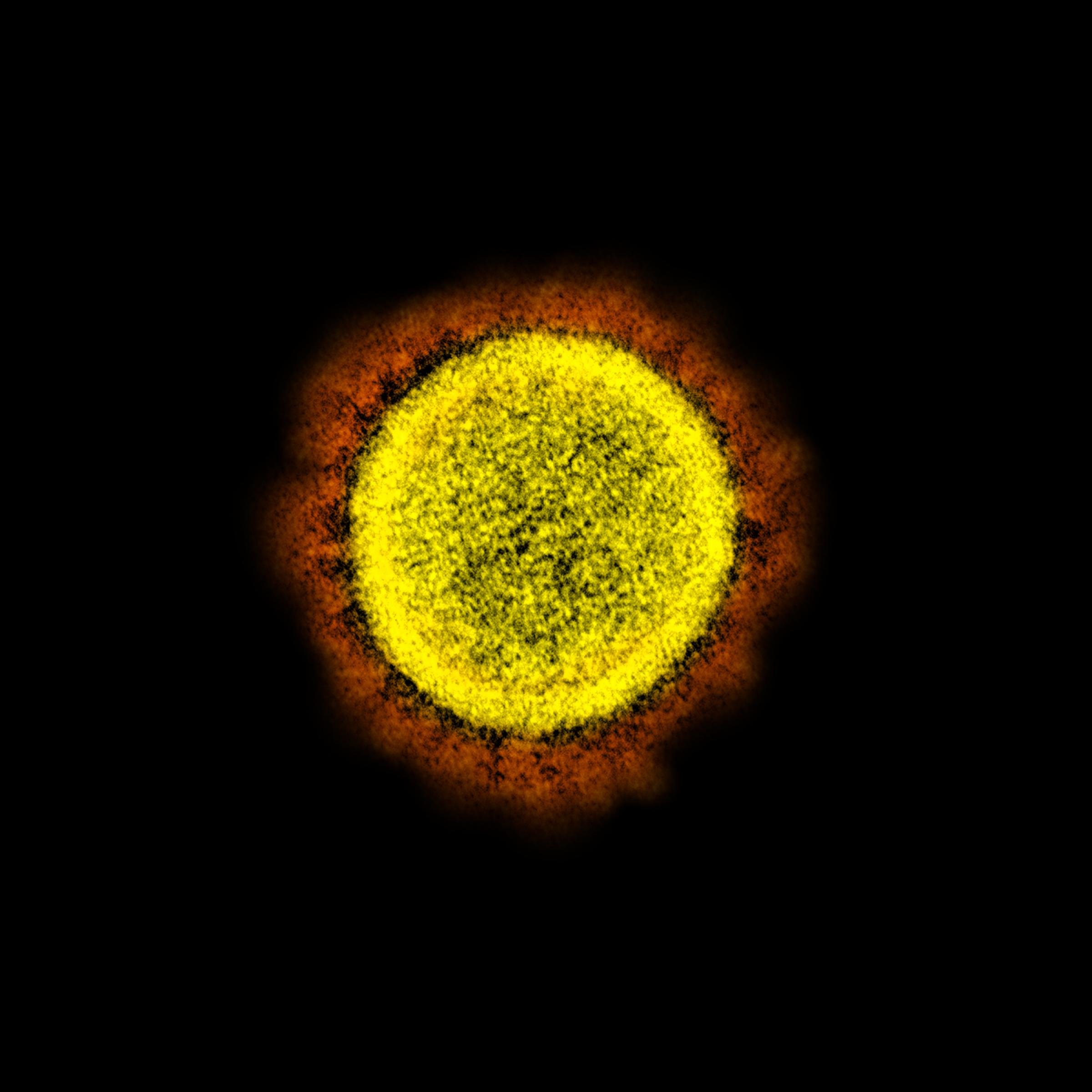 Das Bild zeigt das Coronavirus. Es ist kreisförmig, mit spornartigen Aufsätzen auf der Hülle. Seine Größe beträgt rund 120 Nanometer.