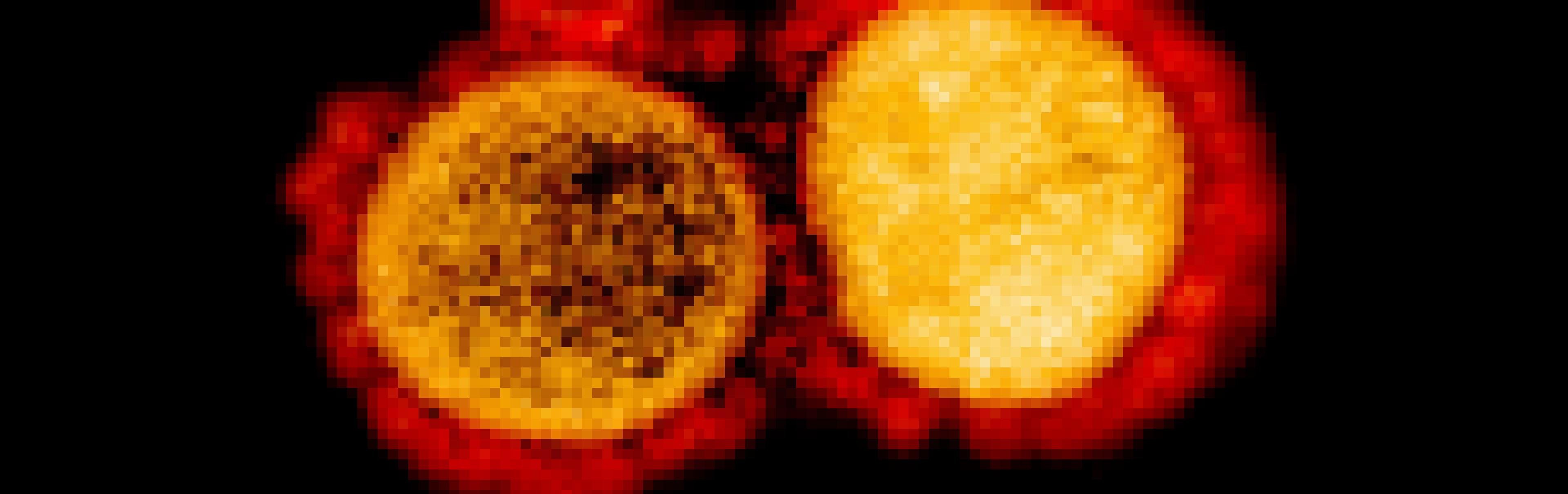 Das Bild zeigt zwei Coronaviren in einer extremen Vergrößerung. Sie sind rundlich und haben dornenartige Fortsätze, die ihnen beim Eindringen in menschliche Zellen helfen.