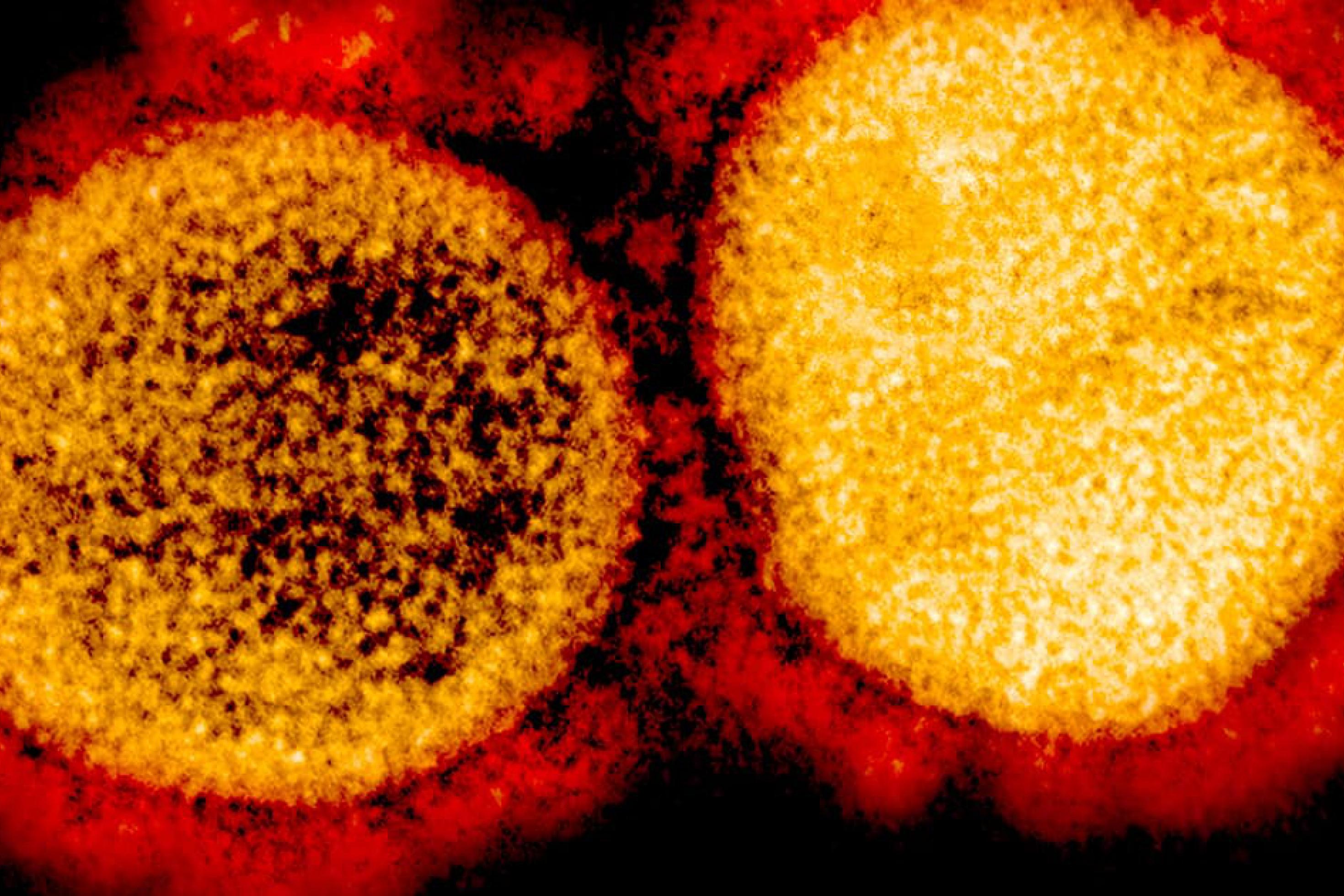 Das Bild zeigt zwei Coronaviren in einer extremen Vergrößerung. Sie sind rundlich und haben dornenartige Fortsätze, die ihnen beim Eindringen in menschliche Zellen helfen.