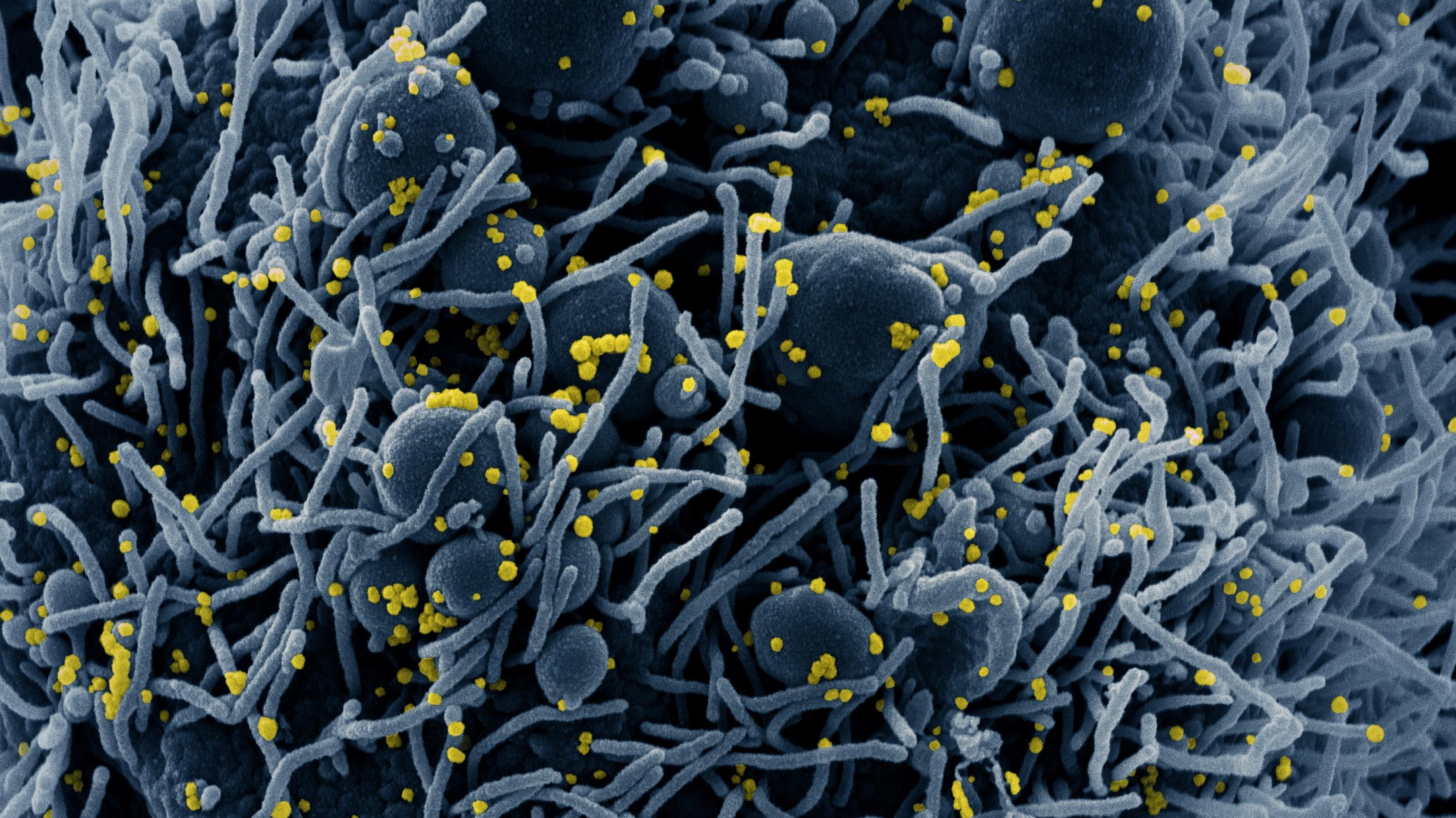 Mehrere menschliche Zellen mit einer zottigen Oberfläche. Darauf sitzen kleine gelb eingefärbte Viren.