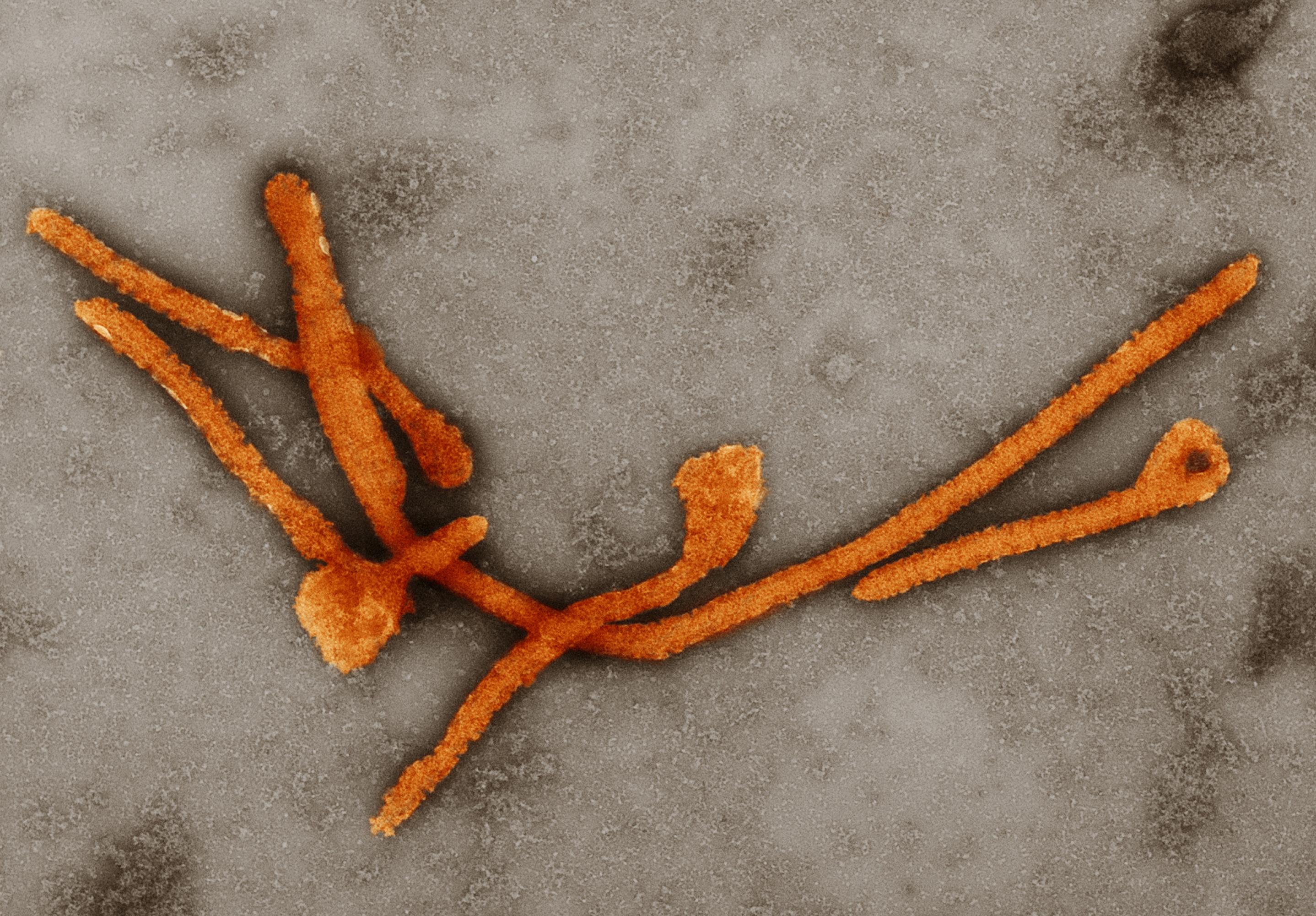 Das Bild zeigt eine elektronenmikroskopische Aufnahme des Ebolavirus, die am Robert Koch-Institut gemacht wurde. Vor grauem Hintergrund sind die orange eingefärbten stäbchenförmigen Strukturen des Virus zu erkennen. Gegen Ebola gibt es inzwischen einen Impfstoff und mehrere Medikamente. Eines der Medikamente, Remdesivir, wird zurzeit als möglicher Wirkstoff gegen Corona getestet. Ebola ist auf Afrika südlich der Sahara begrenzt und fordert mit einer Sterblichkeit von 30 bis 90 Prozent der Betroffenen viel mehr Opfer als Covid-19.