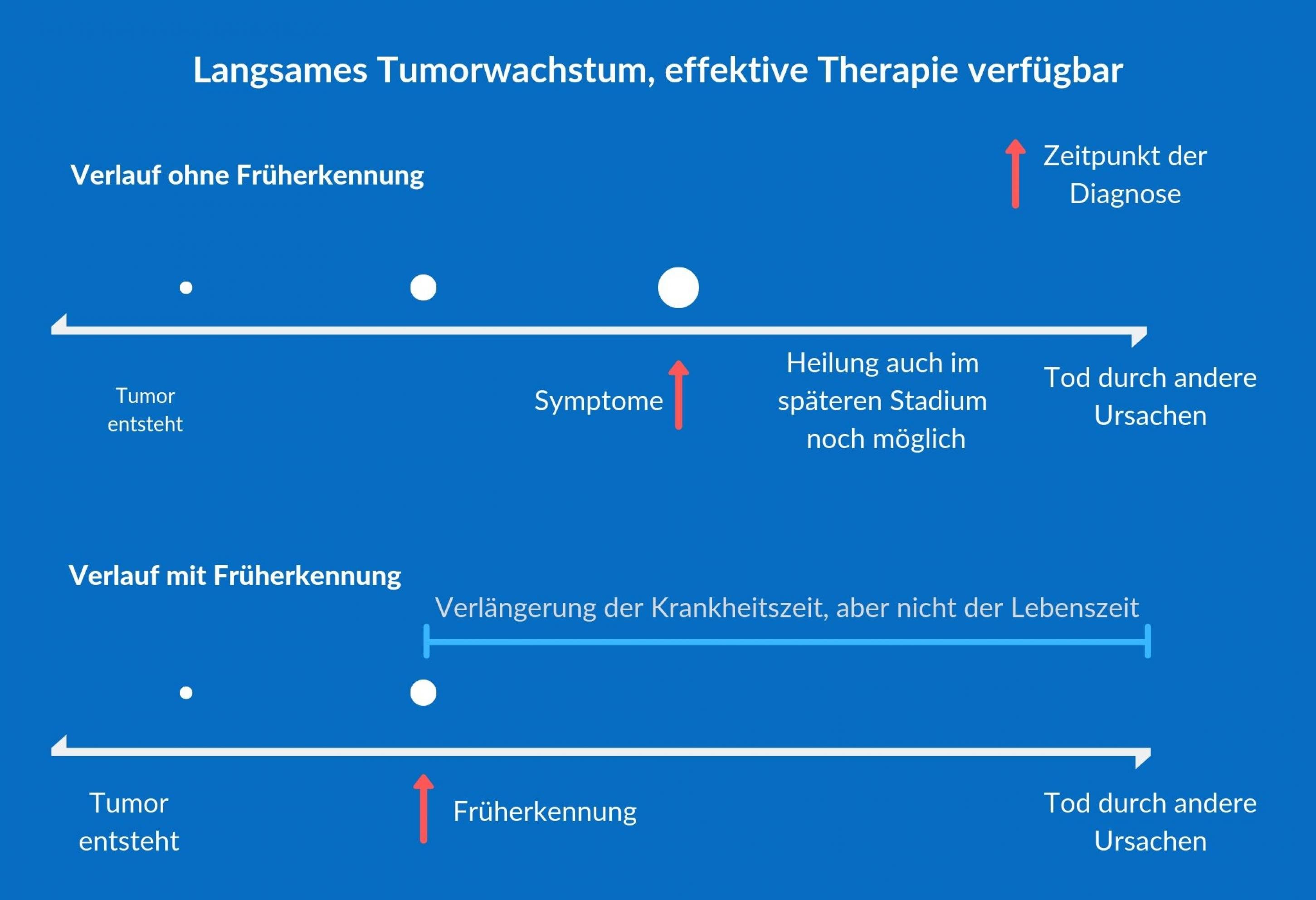 Die Grafik beschreibt ein mögliches Szenario bei der Krebsfrüherkennung: Die Früherkennung nützt manchmal nicht, wenn der Tumor nur langsam wächst und effektive Therapien verfügbar sind.