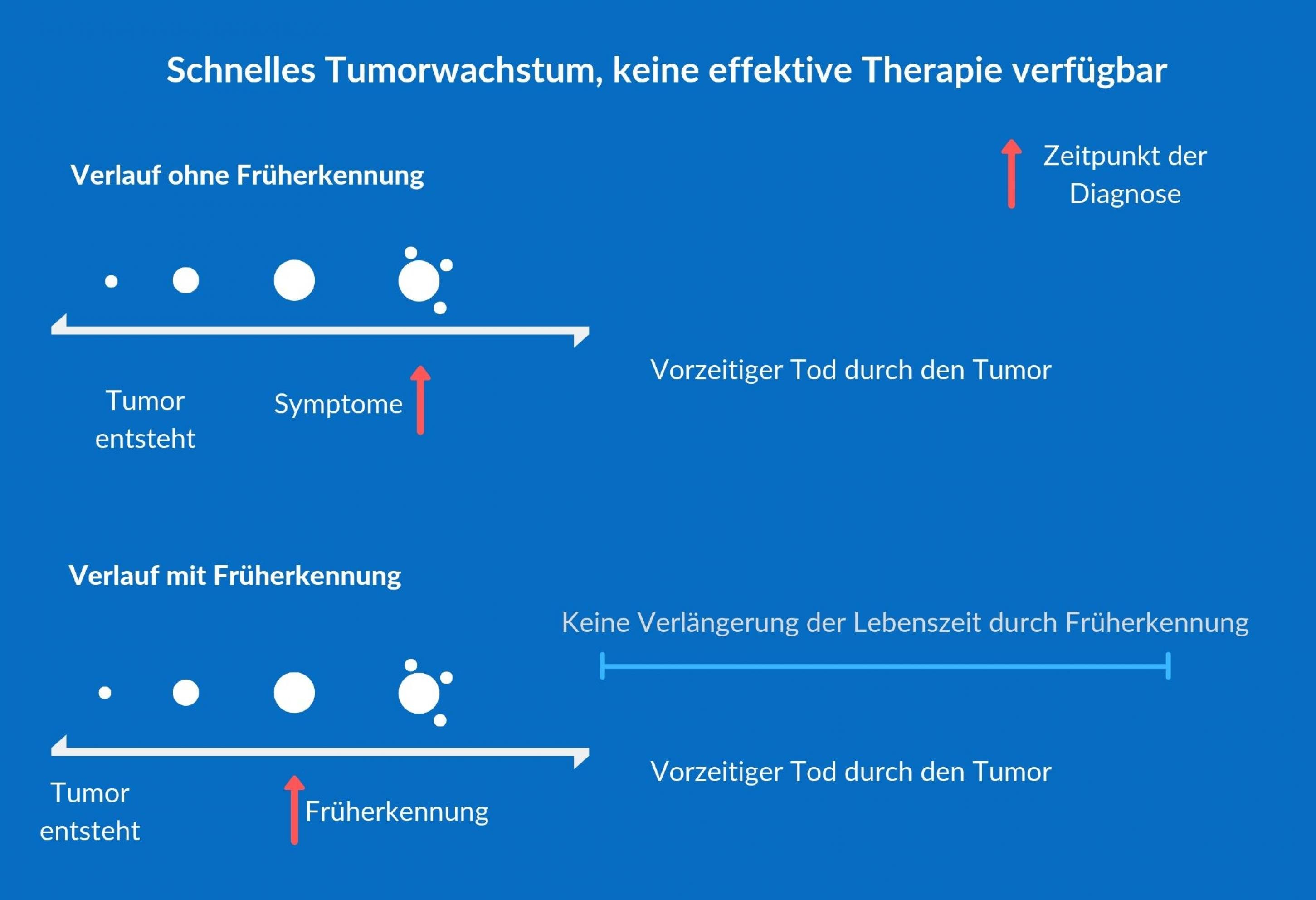 Die Grafik beschreibt ein mögliches Szenario bei der Krebsfrüherkennung: Die Früherkennung nützt manchmal nicht, wenn der Tumor sehr schnell wächst und keine effektive Therapien verfügbar sind.