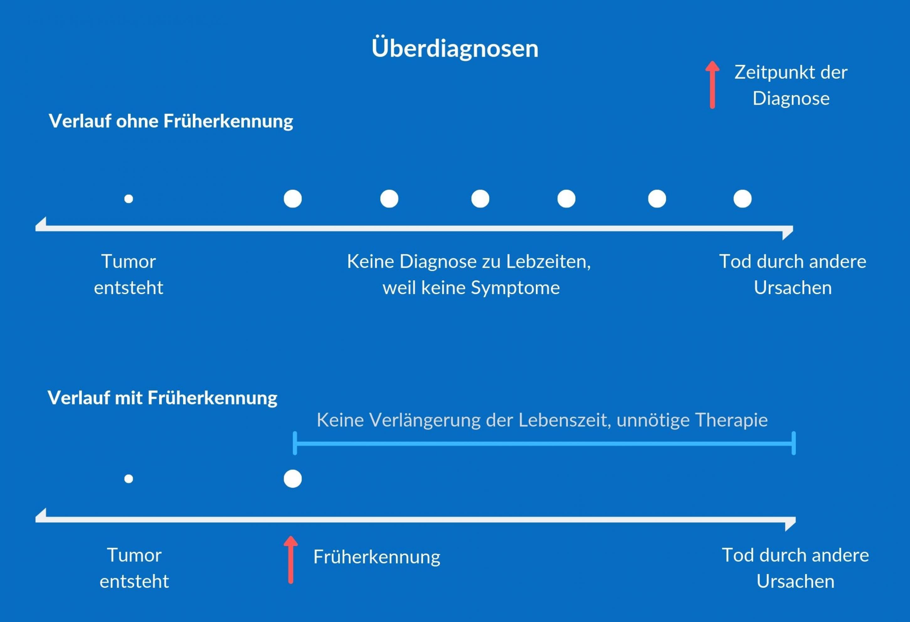 Die Grafik beschreibt ein mögliches Szenario bei der Krebsfrüherkennung: Wenn die Früherkennung Tumore entdeckt, die zu Lebzeiten sonst nicht aufgefallen wären und auch nicht hätten behandelt werden müssen, spricht man von Überdiagnosen.