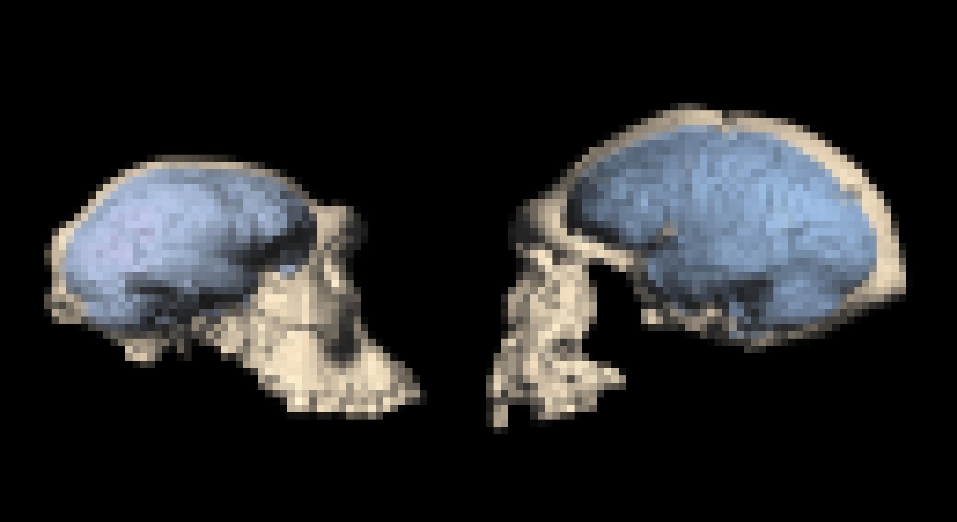 Das Foto zeigt zwei helle Urmenschen-Schädel, die sich gegenüberstehen und ansehen. Blau eingezeichnet sind die Hirnstrukturen. Der linke Schädel, aus Georgien stammend, wirkt primitiver, der rechte Schädel ist größer und wirkt fortschrittlicher. Vor allem das Stirnhirn ist dort stärker entwickelt und lässt auf höhere geistige Fähigkeiten schließen.