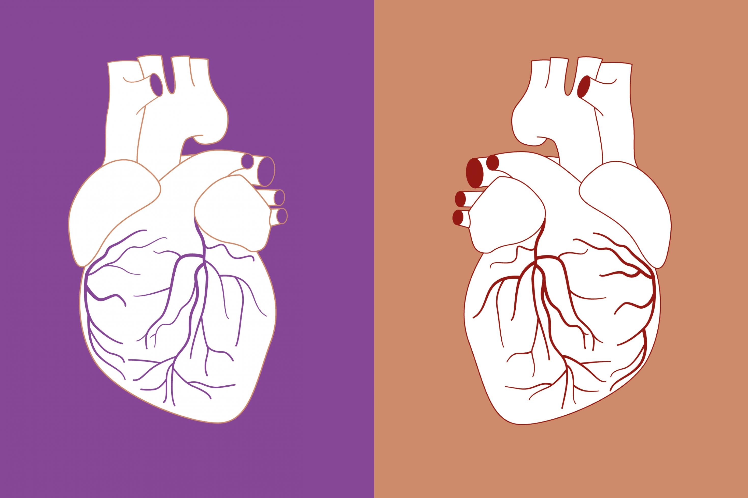 Das Bild ist in eine linke und eine rechte Hälfte geteilt. Links ist eine Zeichnung eines menschlichen Herzens vor einem lila Hintergrund zu sehen. Rechts ist die gleiche Zeichnung spiegelverkehrt vor einem beigen Hintergrund zu sehen.