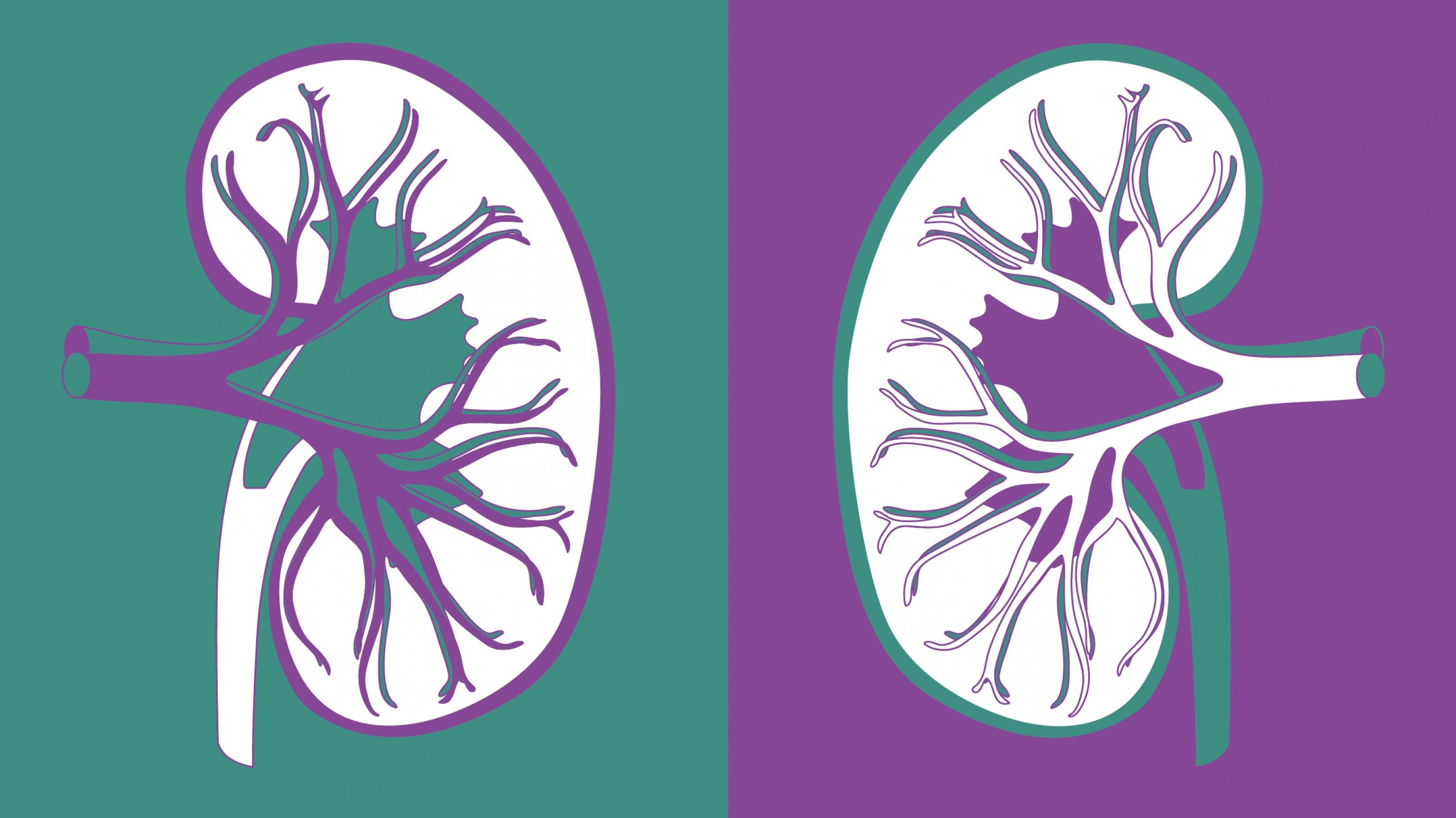 Das Bild ist in eine linke und eine rechte Hälfte geteilt. Links ist eine Zeichnung einer menschlichen Niere in violetten Linien vor einem grünen Hintergrund zu sehen. Rechts ist die gleiche Zeichnung spiegelverkehrt in violetten Linien vor einem grünen Hintergrund zu sehen.