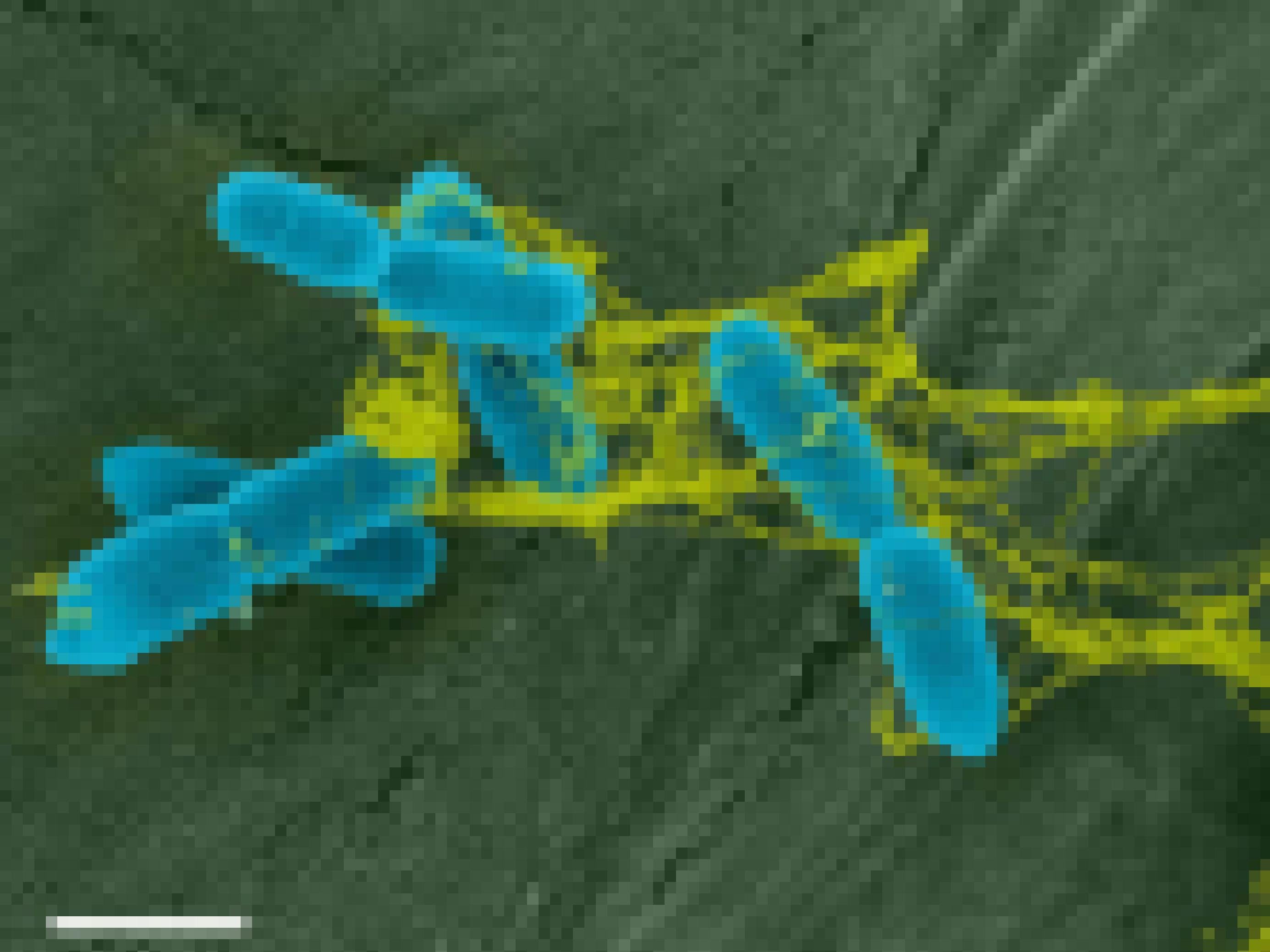 Blau gefärbte Bakterien hängen in einem gelb gefärbten Netz fest, das an ein verklebtes Spinnennetz erinnert.