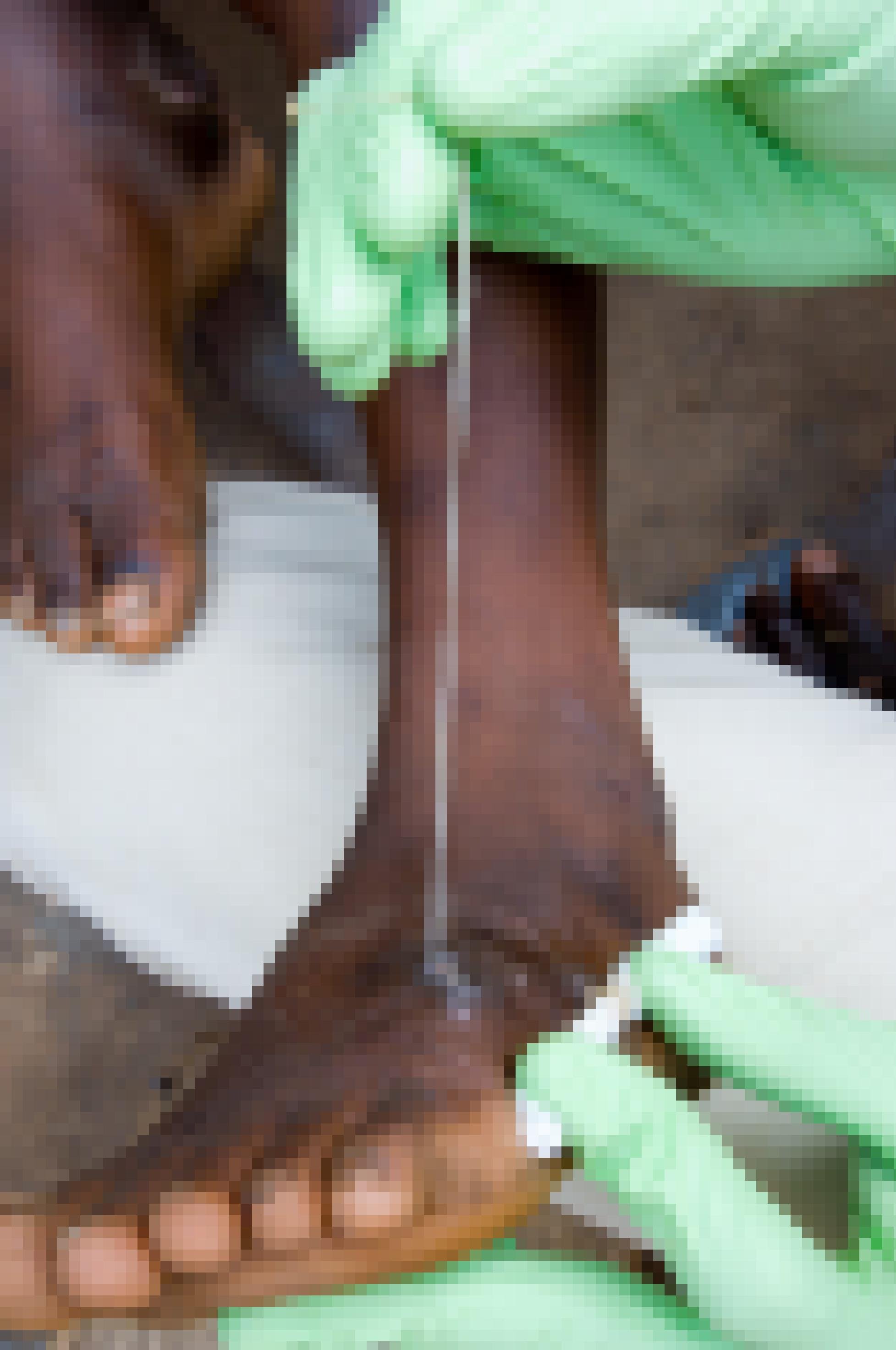 Ein Fuß, aus dem ein langer weißer Guineawurm gezogen und dabei aufgewickelt wird.
